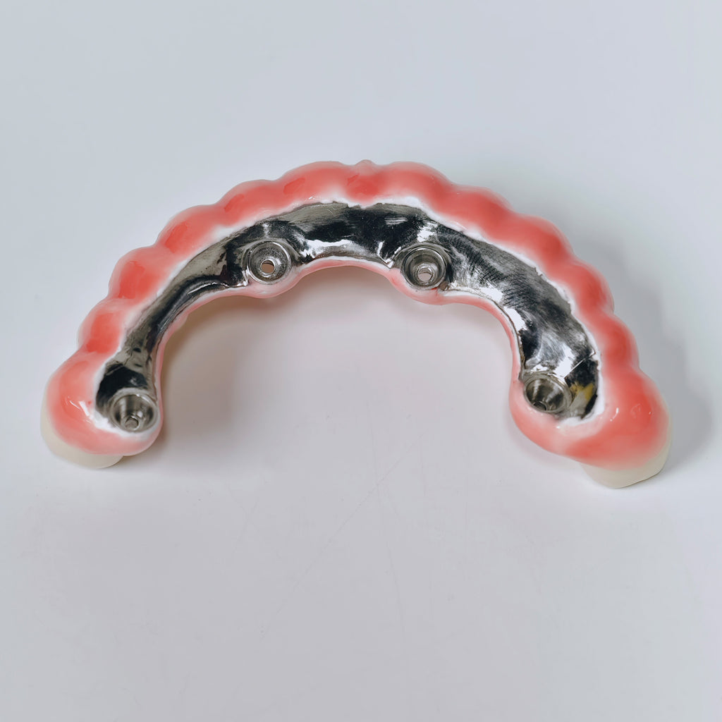 Zirconia-Enamel Hybrid Malo Bridge