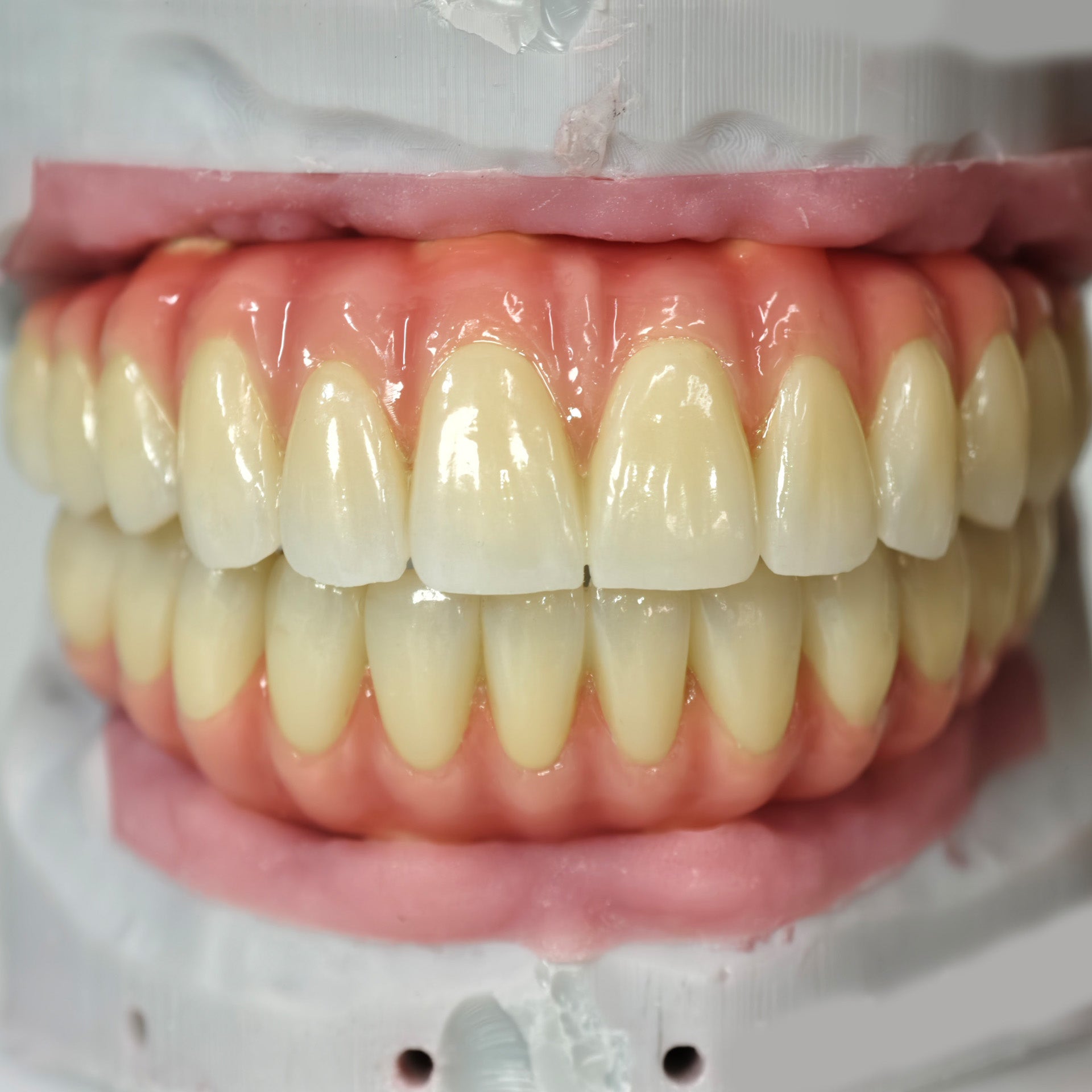 Zirconia-Enamel Hybrid Malo Bridge