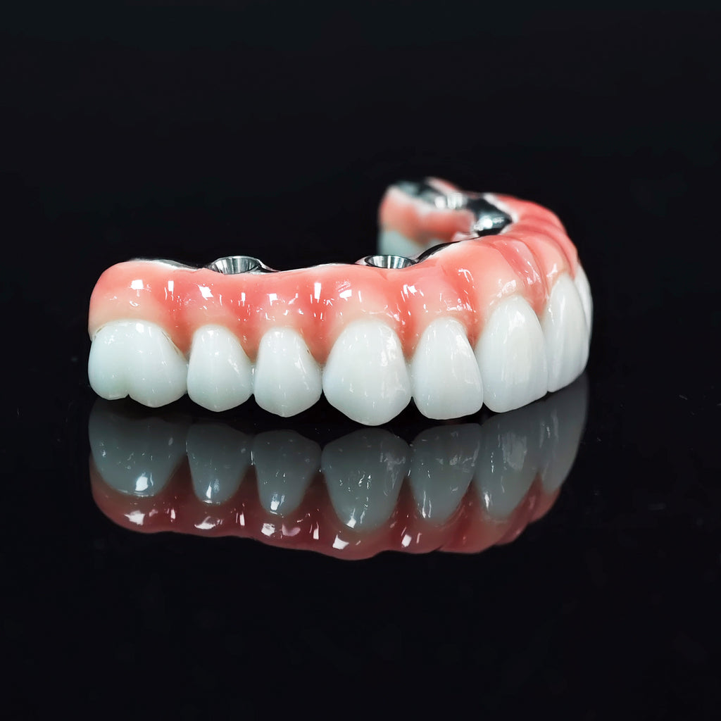 Zirconia-Enamel Hybrid Malo Bridge