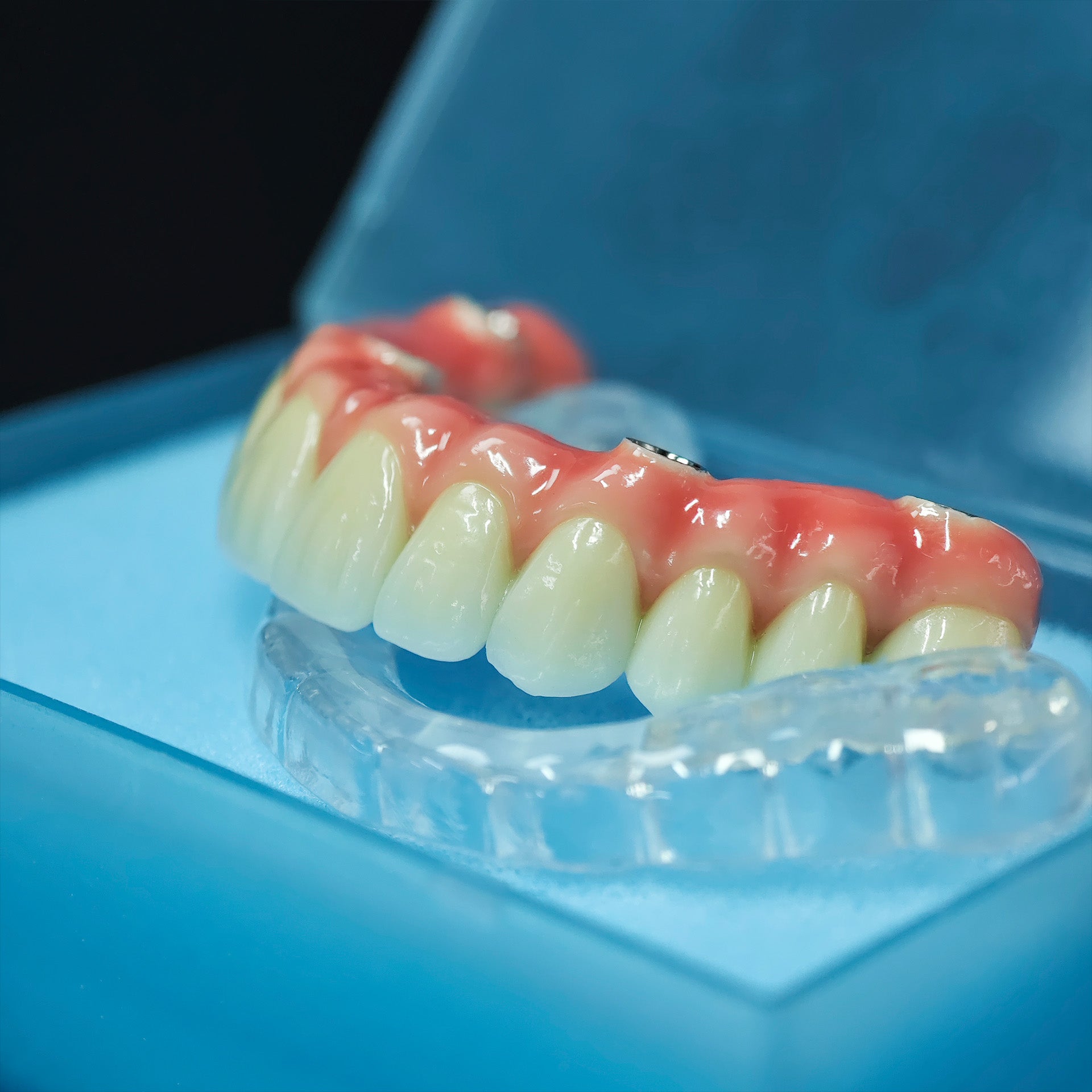 Zirconia-Enamel Hybrid Malo Bridge