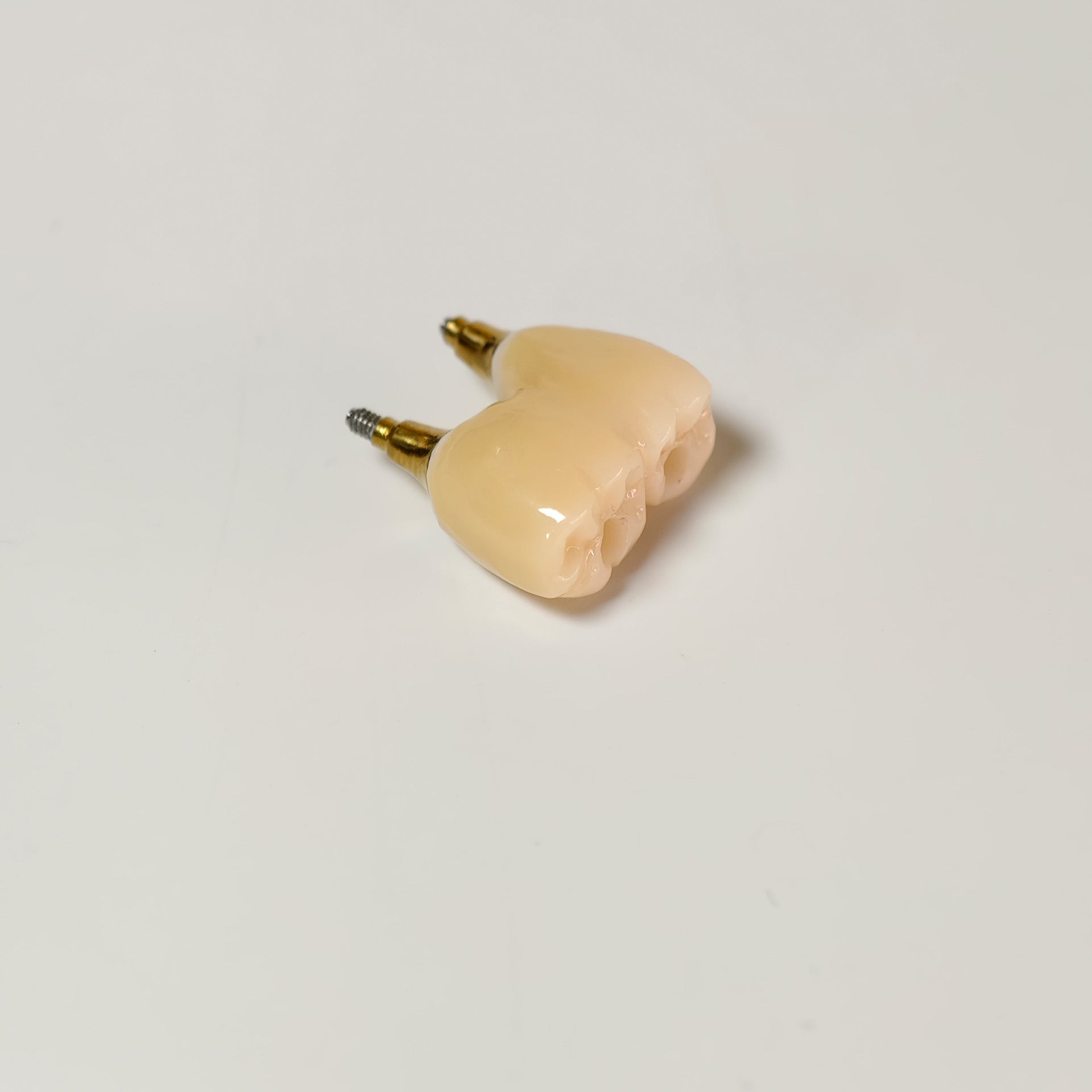 Zirconia Bridge With Screw Retained