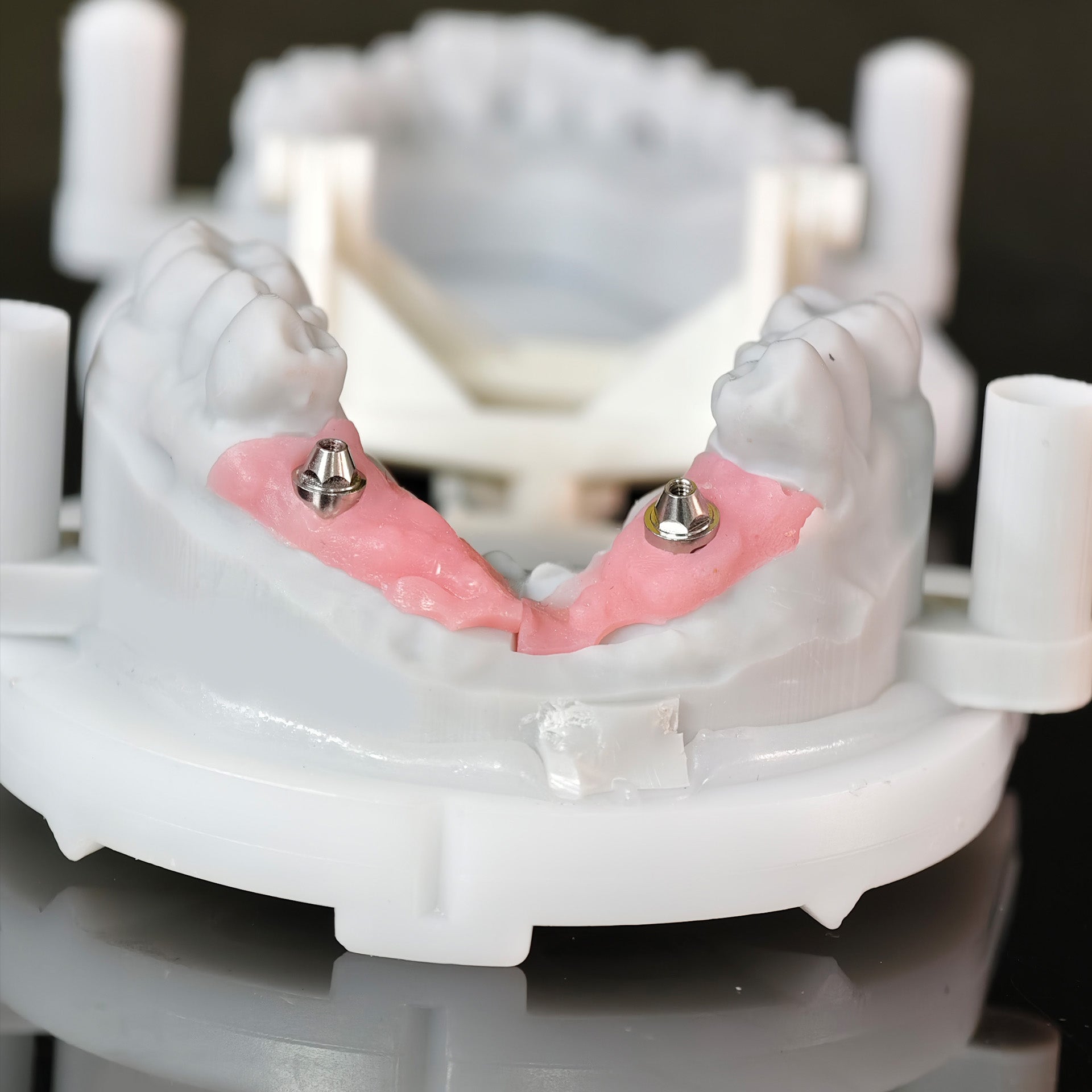 Zirconia Bridge With Ti-Base Screw Retained