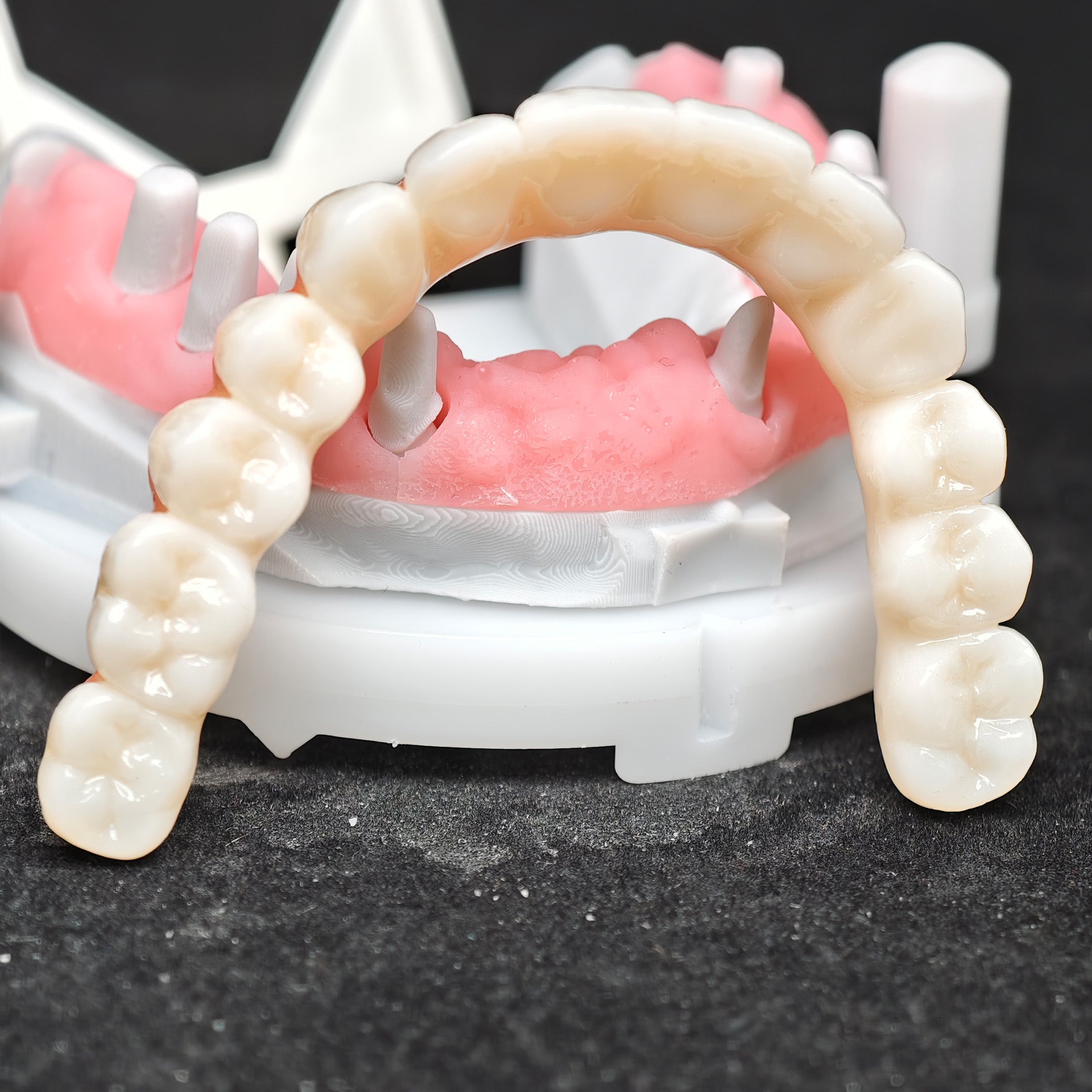 Zirconia Bridge With Cement Retained
