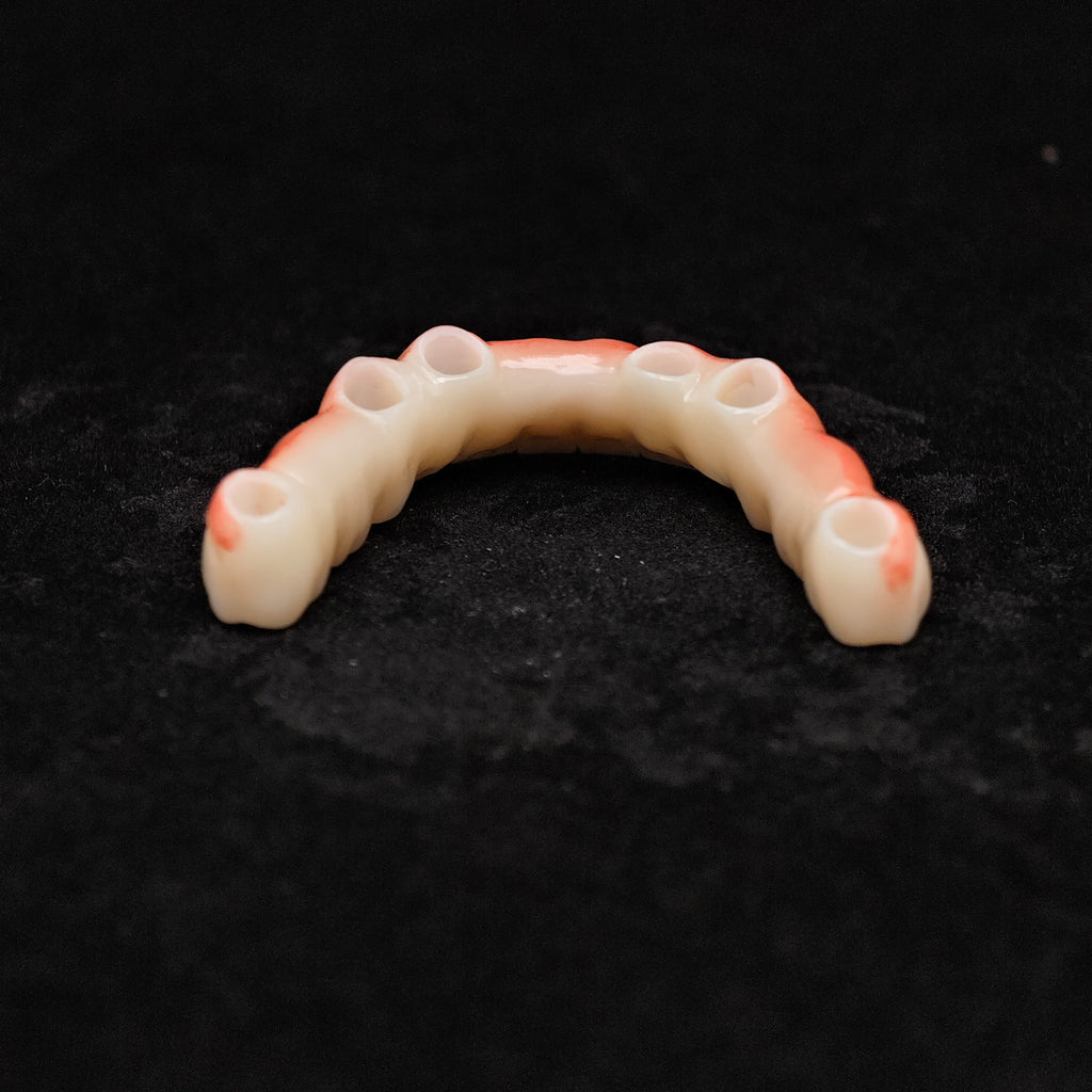 Zirconia Bridge With Cement Retained