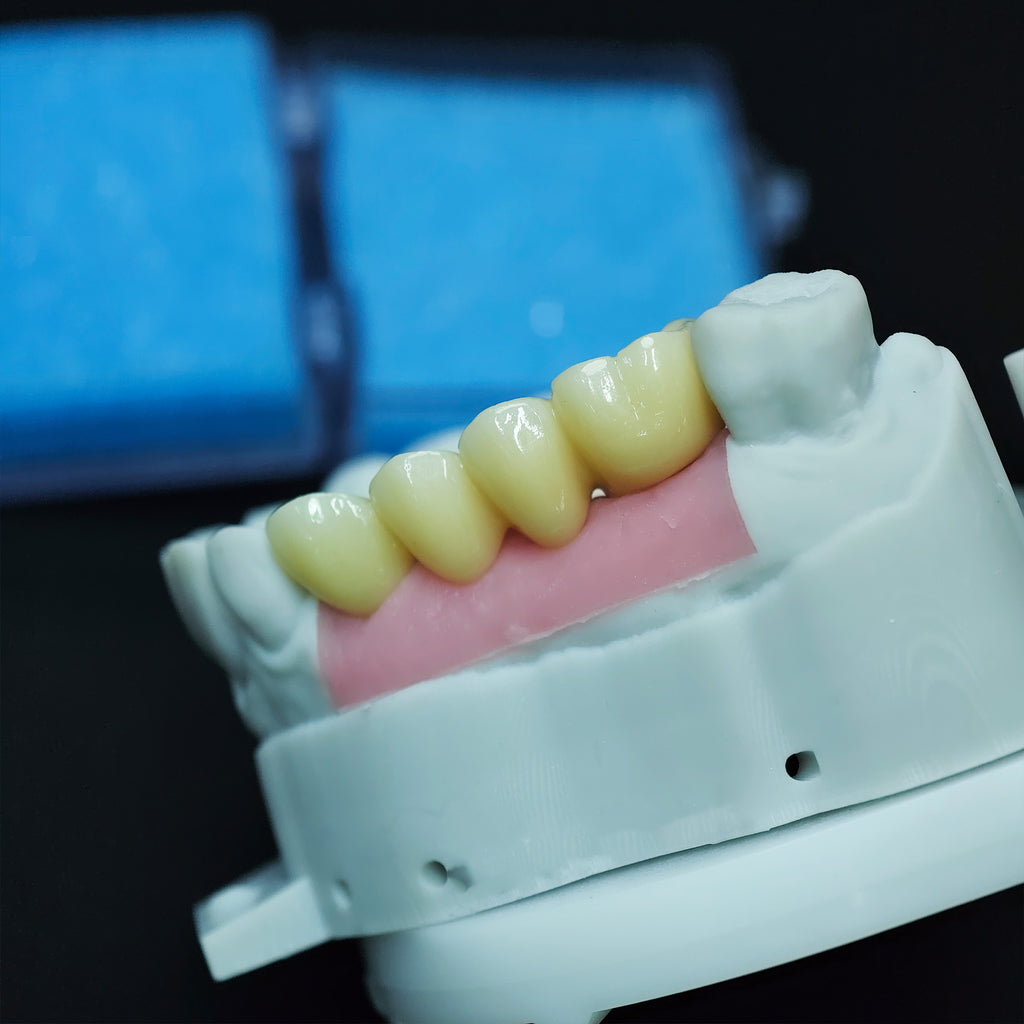 Zirconia Bridge With Screw Retained