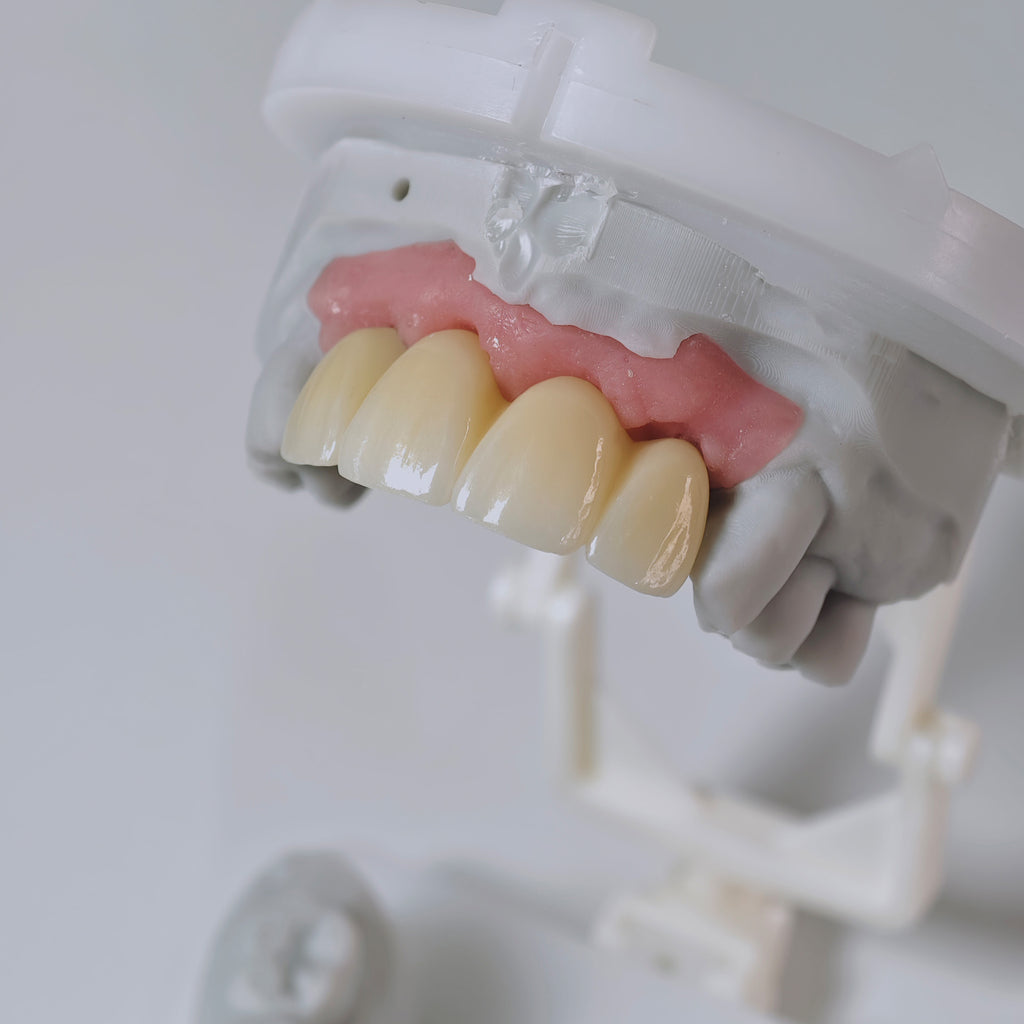 Zirconia Bridge With Screw Retained