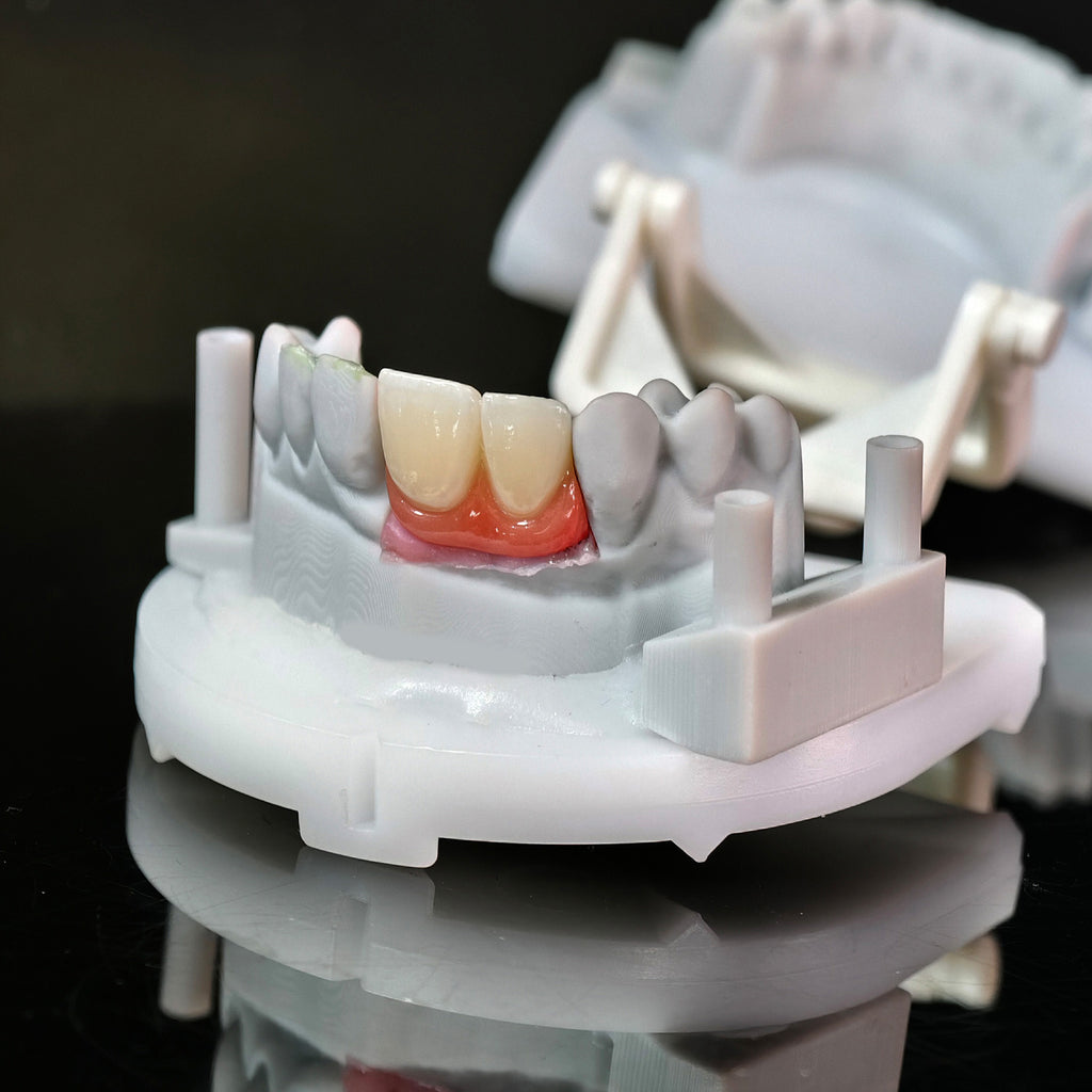 Zirconia Bridge With Ti-Base Bautment