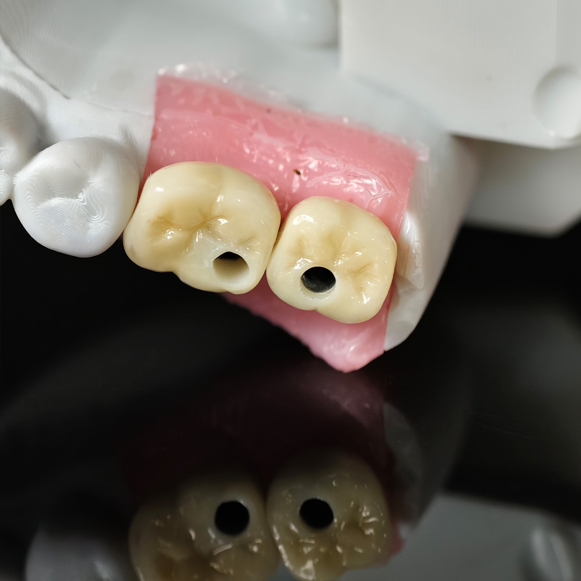 Zirconia Crowns With Screw Retained