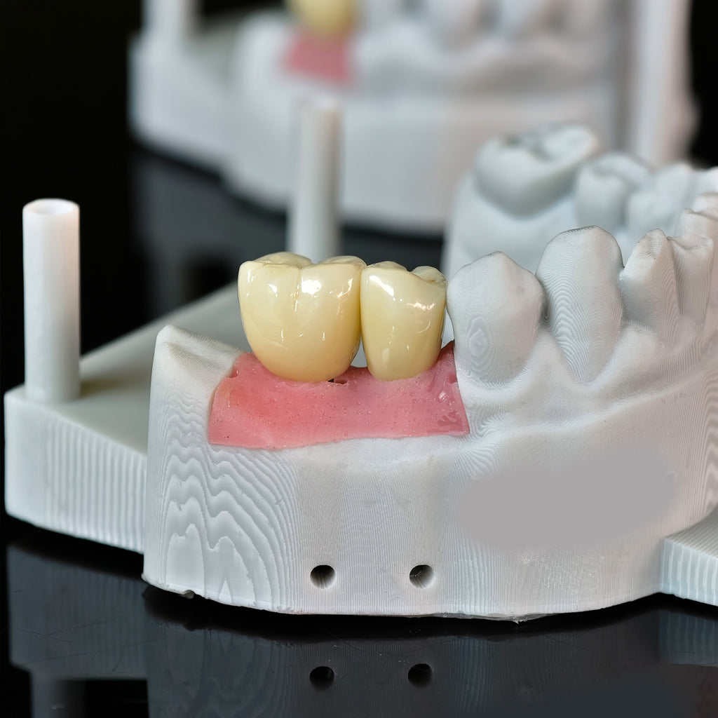 Zirconia Crowns With Screw Retained