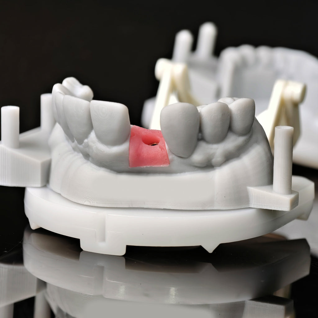 Zirconia Crown With Screw Retained
