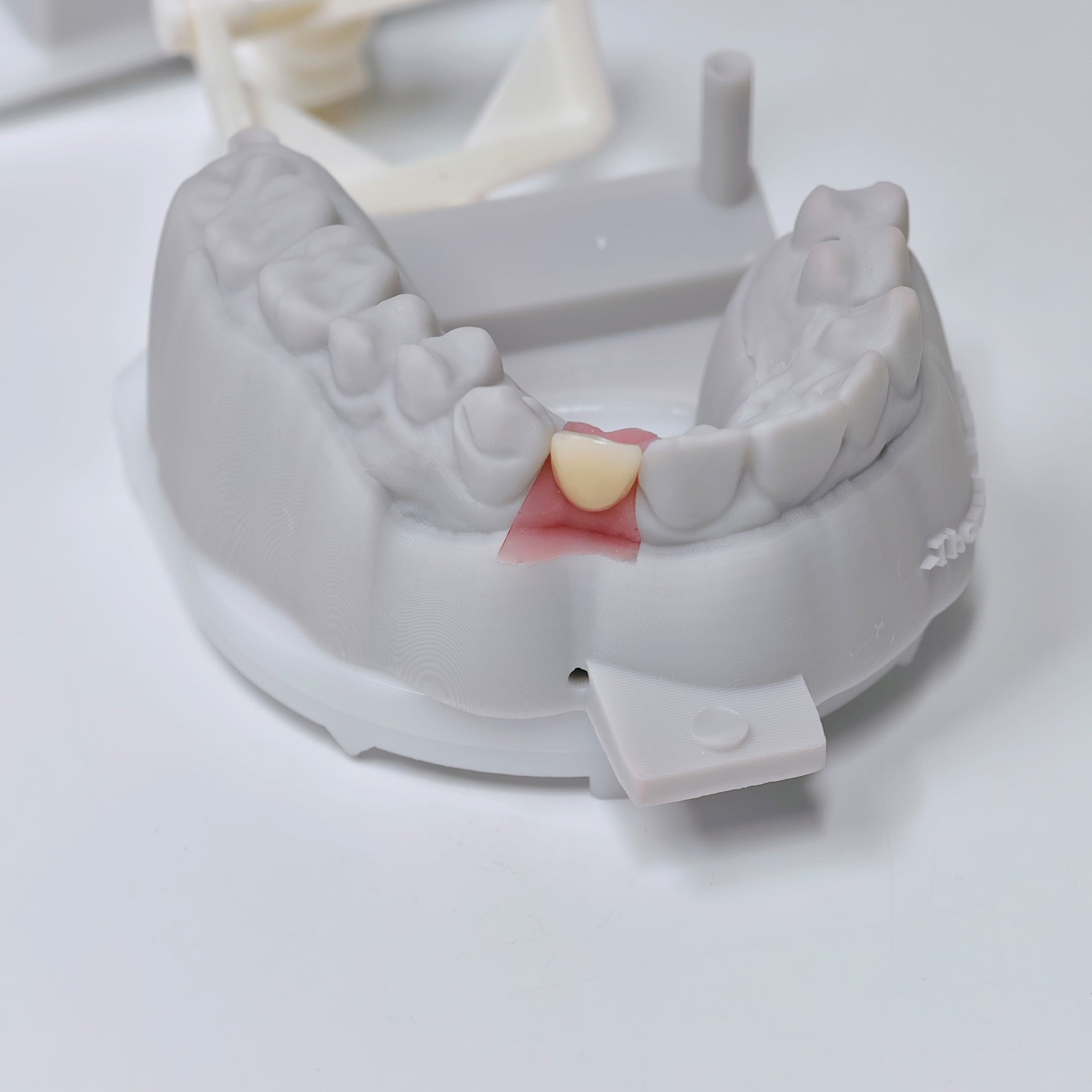 Zirconia Crown With Screw Retained
