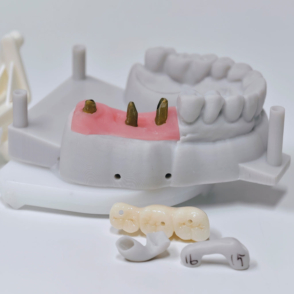 Zirconia Implant Bridge Screwmentable Dental Crown