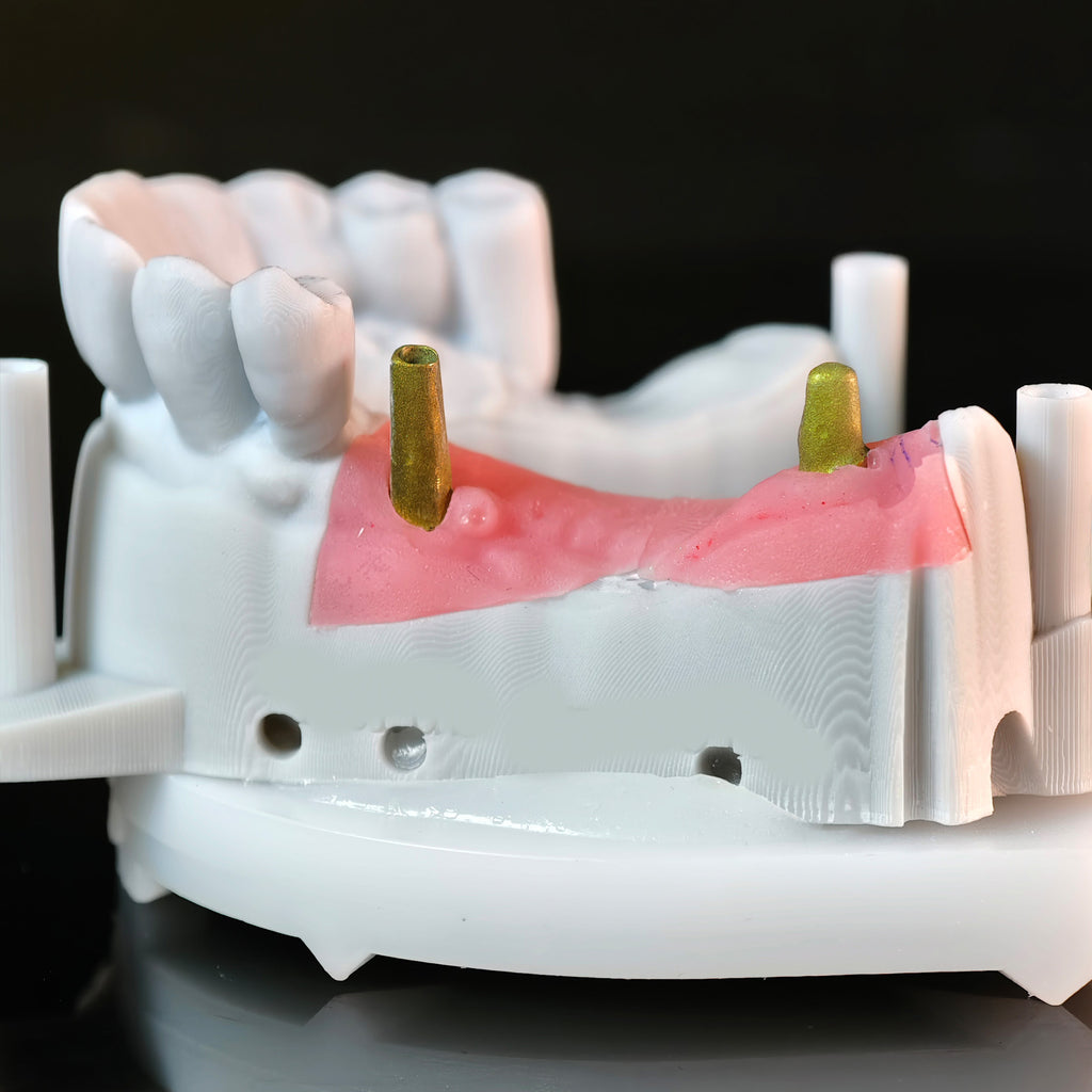 Zirconia Implant Bridge Screwmentable Dental Crown