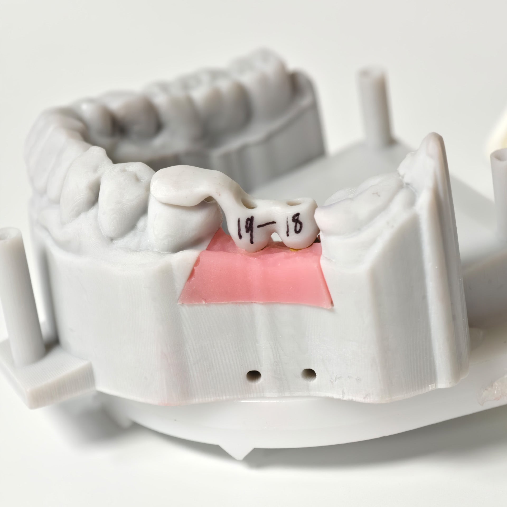 Zirconia Implant Bridge Screwmentable Dental Crown