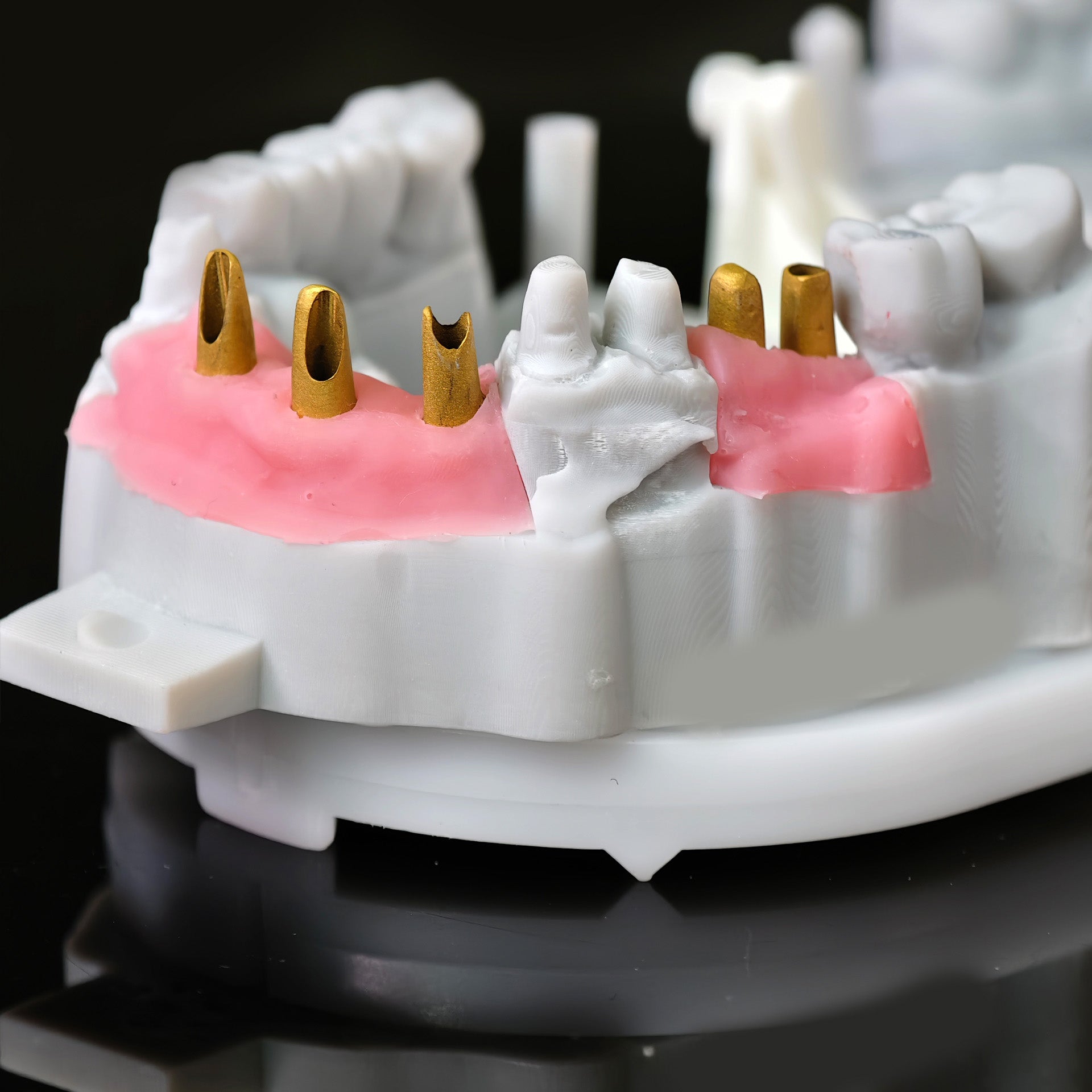 Zirconia Implant Bridge Screwmentable Dental Crown