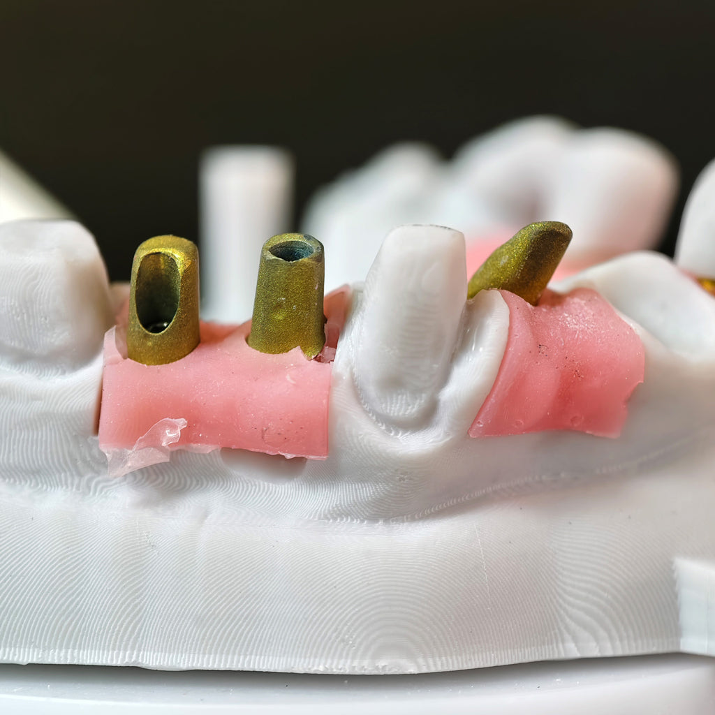 Zirconia Implant Bridge Screwmentable Dental Crown