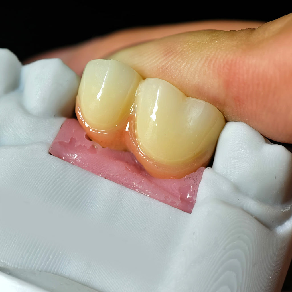 Zirconia Implant Bridge Screwmentable Dental Crown