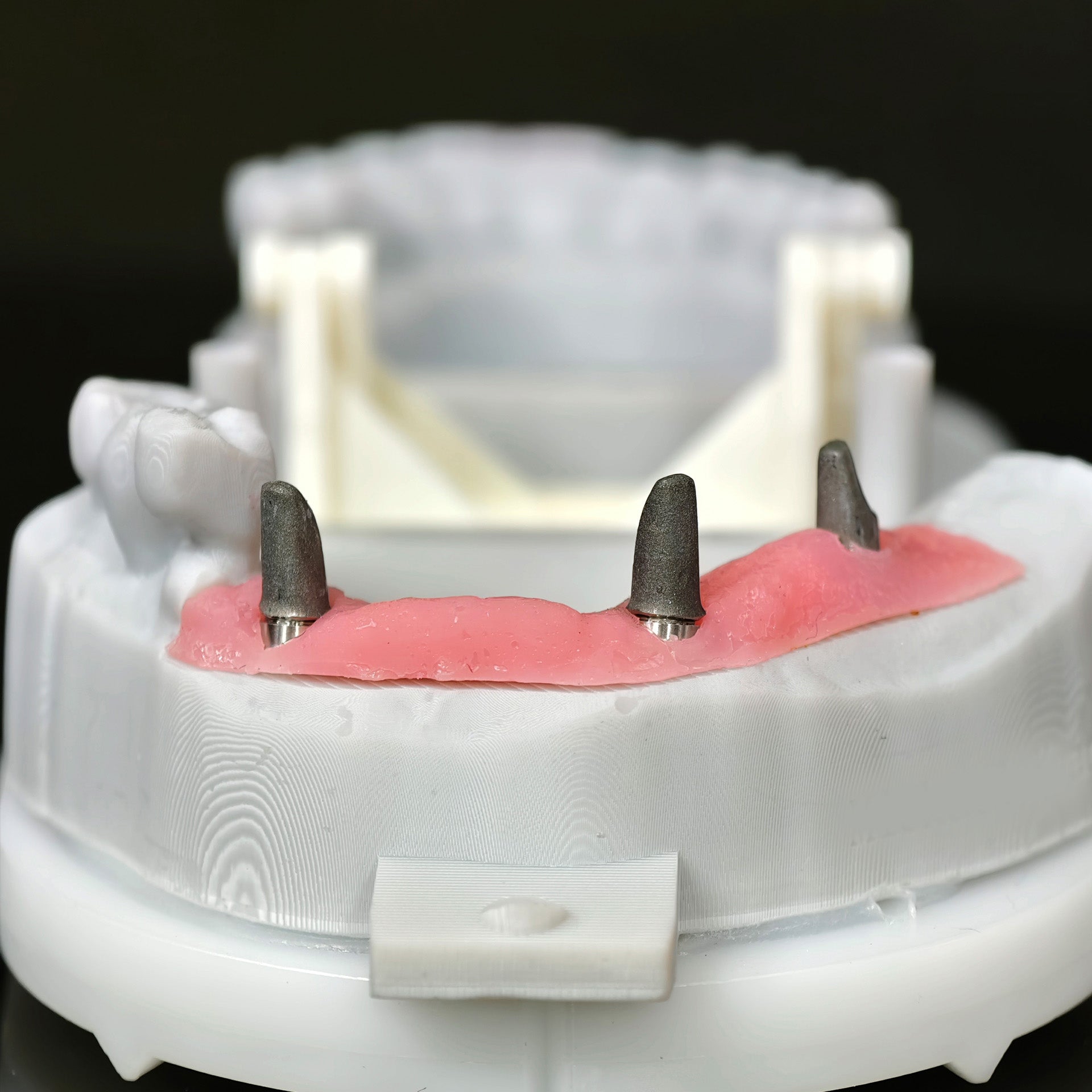 Zirconia Implant Bridge Screwmentable Dental Crown