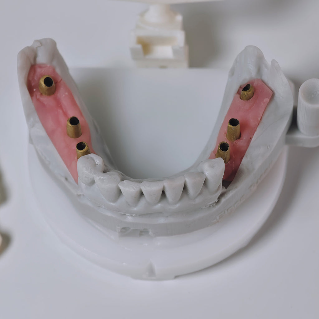 Zirconia Implant Bridges Screwmentable Dental Crown