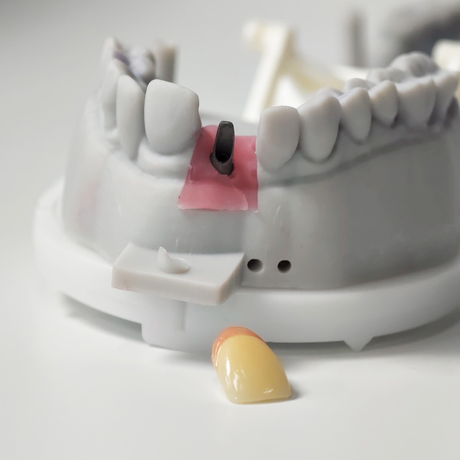 Zirconia Implant Crown Screwmentable Dental Crown