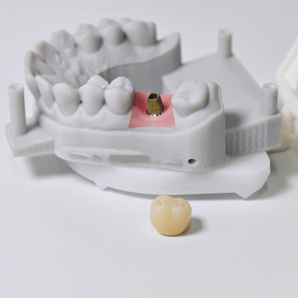Zirconia Implant Crown Screwmentable Dental Crown