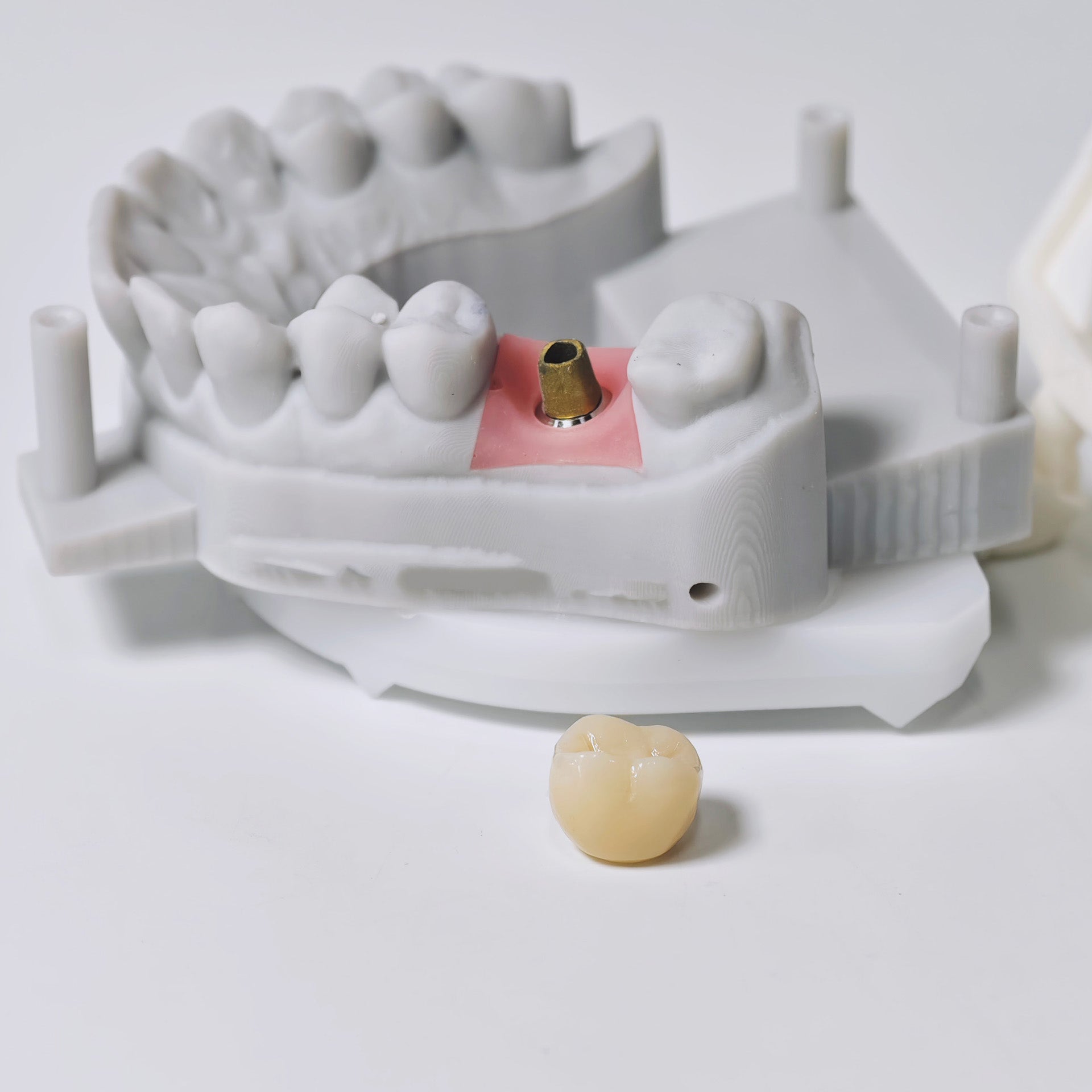 Zirconia Implant Crown Screwmentable Dental Crown