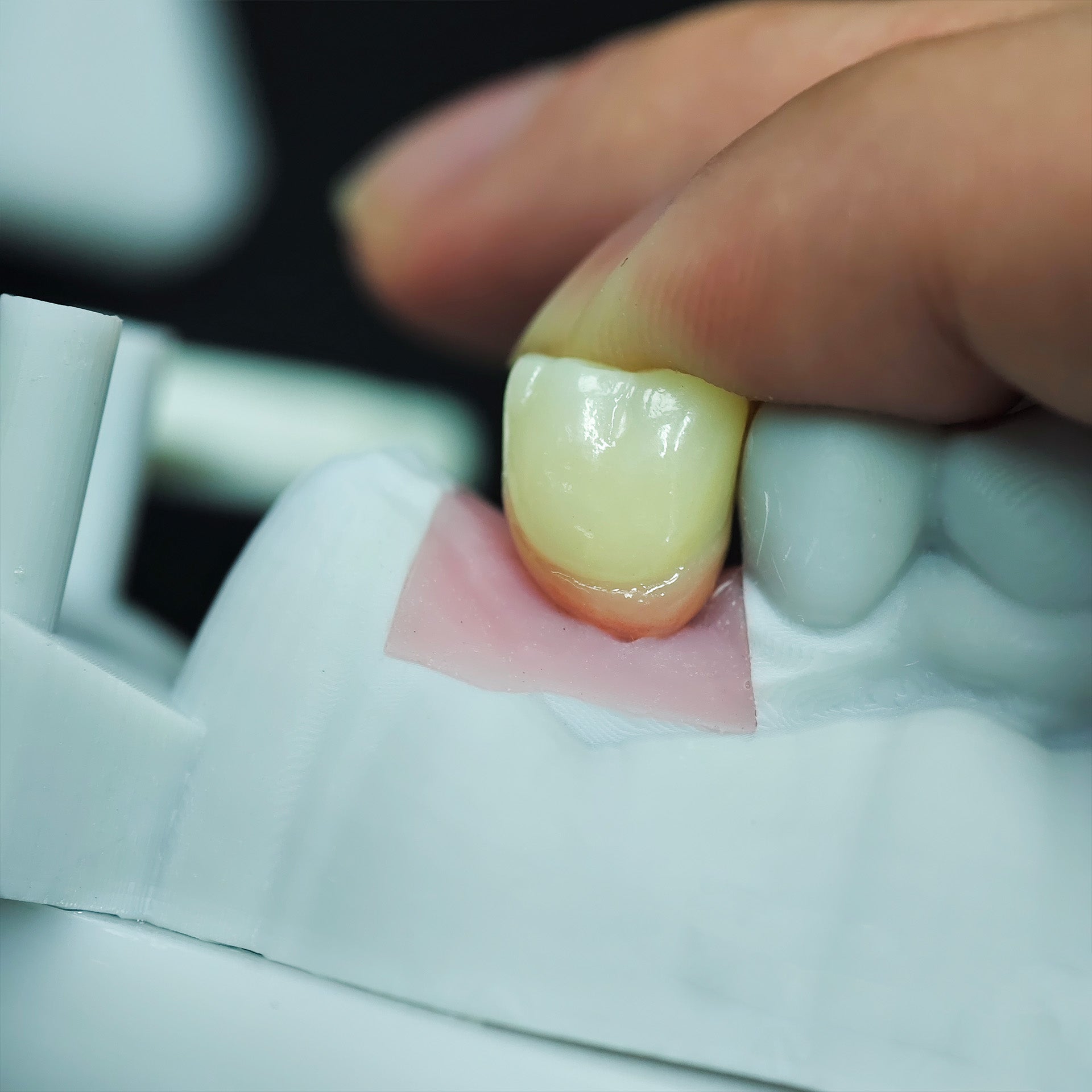 Zirconia Implant Crown Screwmentable Dental Crown
