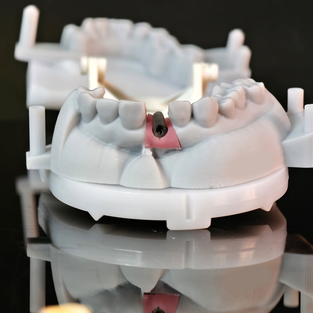 Zirconia Implant Crown Screwmentable Dental Crown
