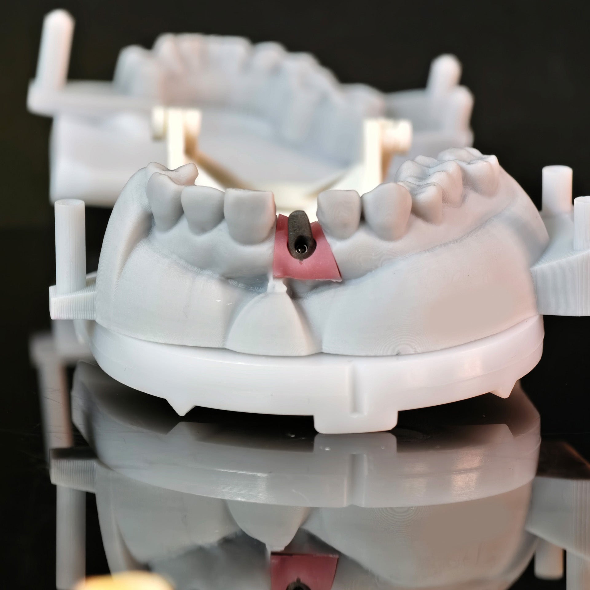 Zirconia Implant Crown Screwmentable Dental Crown