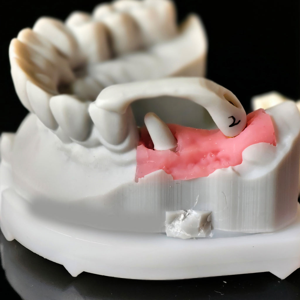 Zirconia Implant Crown Screwmentable Dental Crown