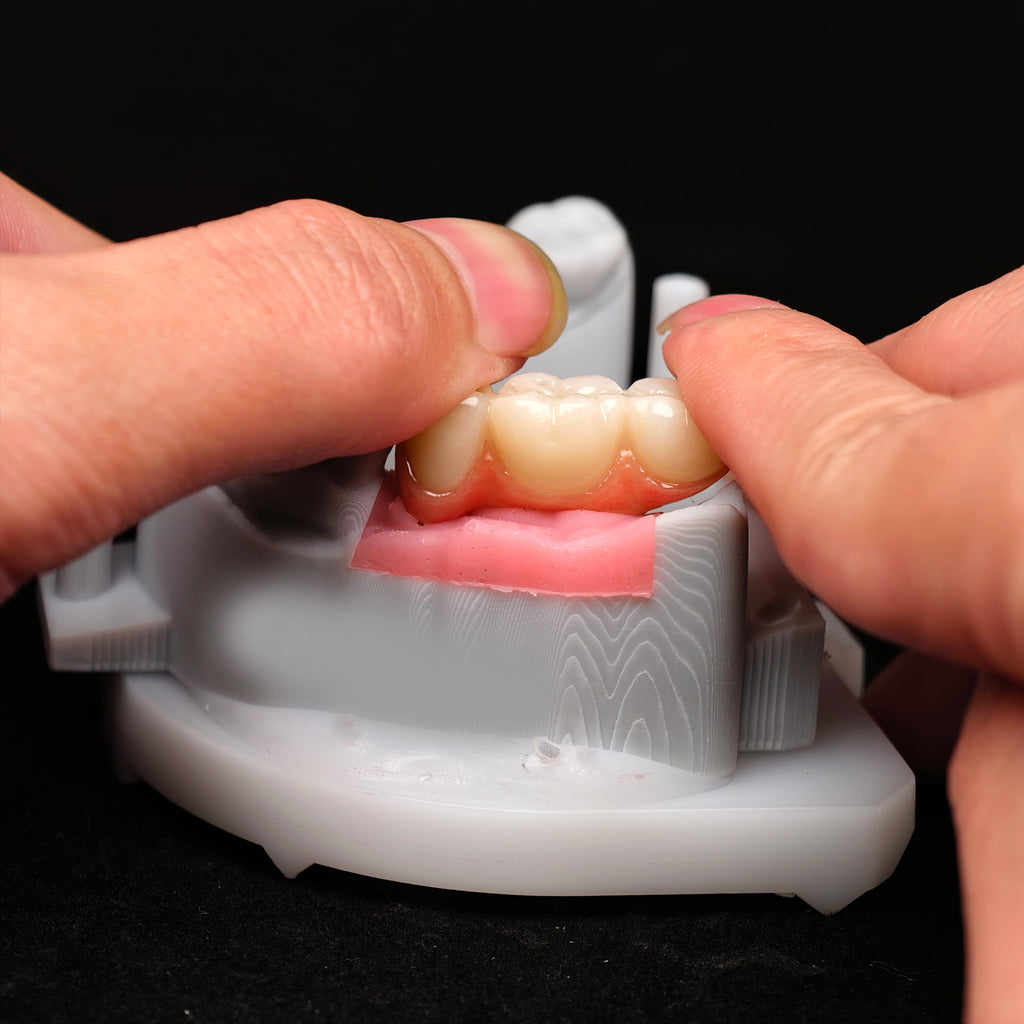 Zirconia Implant Crown Screwmentable Dental Crown