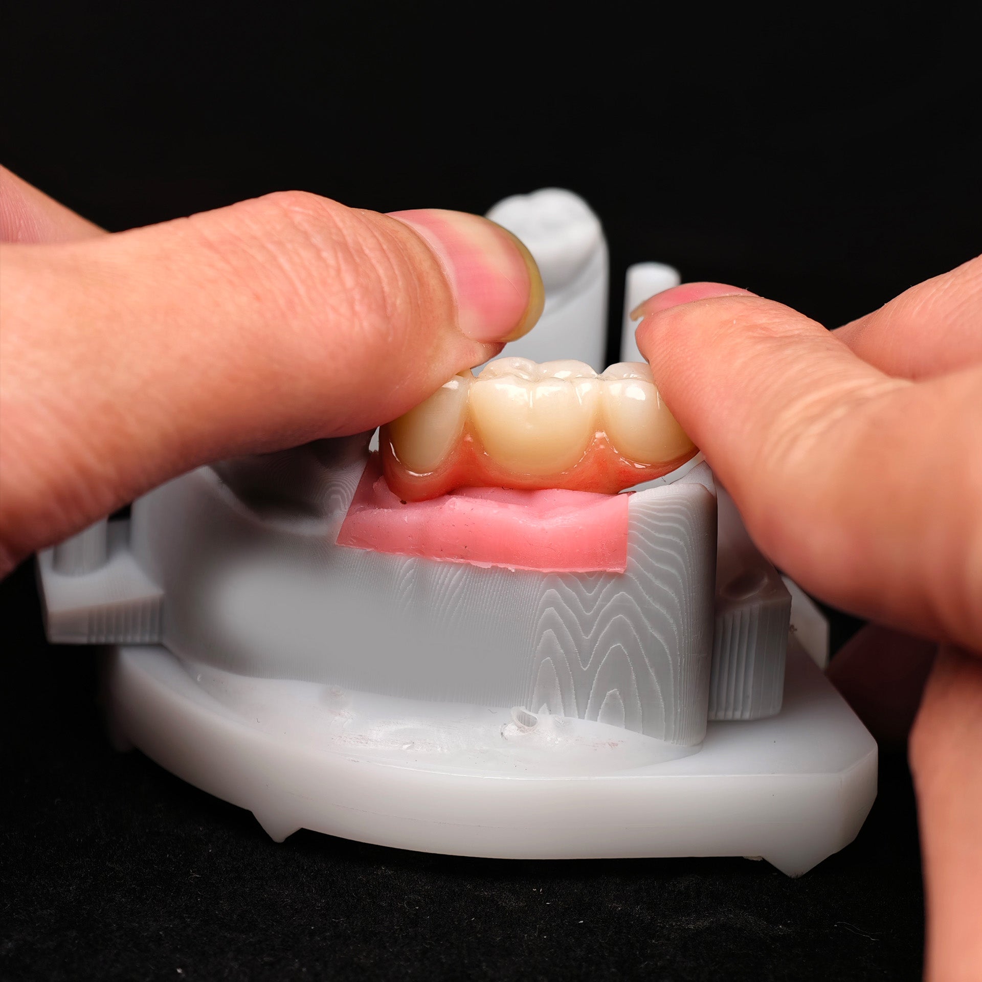 Zirconia Implant Crown Screwmentable Dental Crown