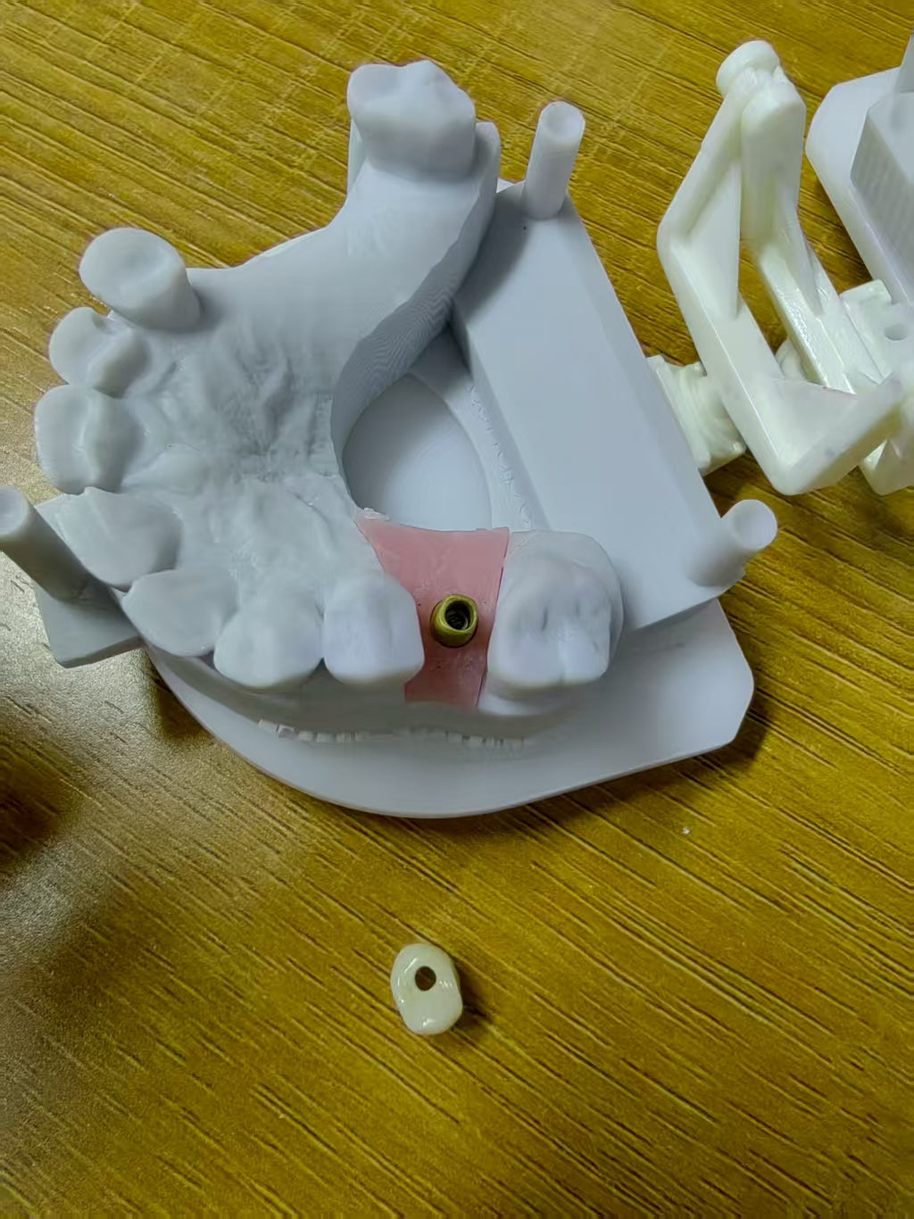 Zirconia Implant Crown Screwmentable Dental Crown