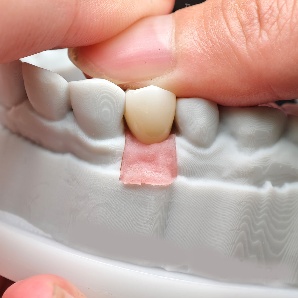 Zirconia Implant Crown Screwmentable Dental Crown