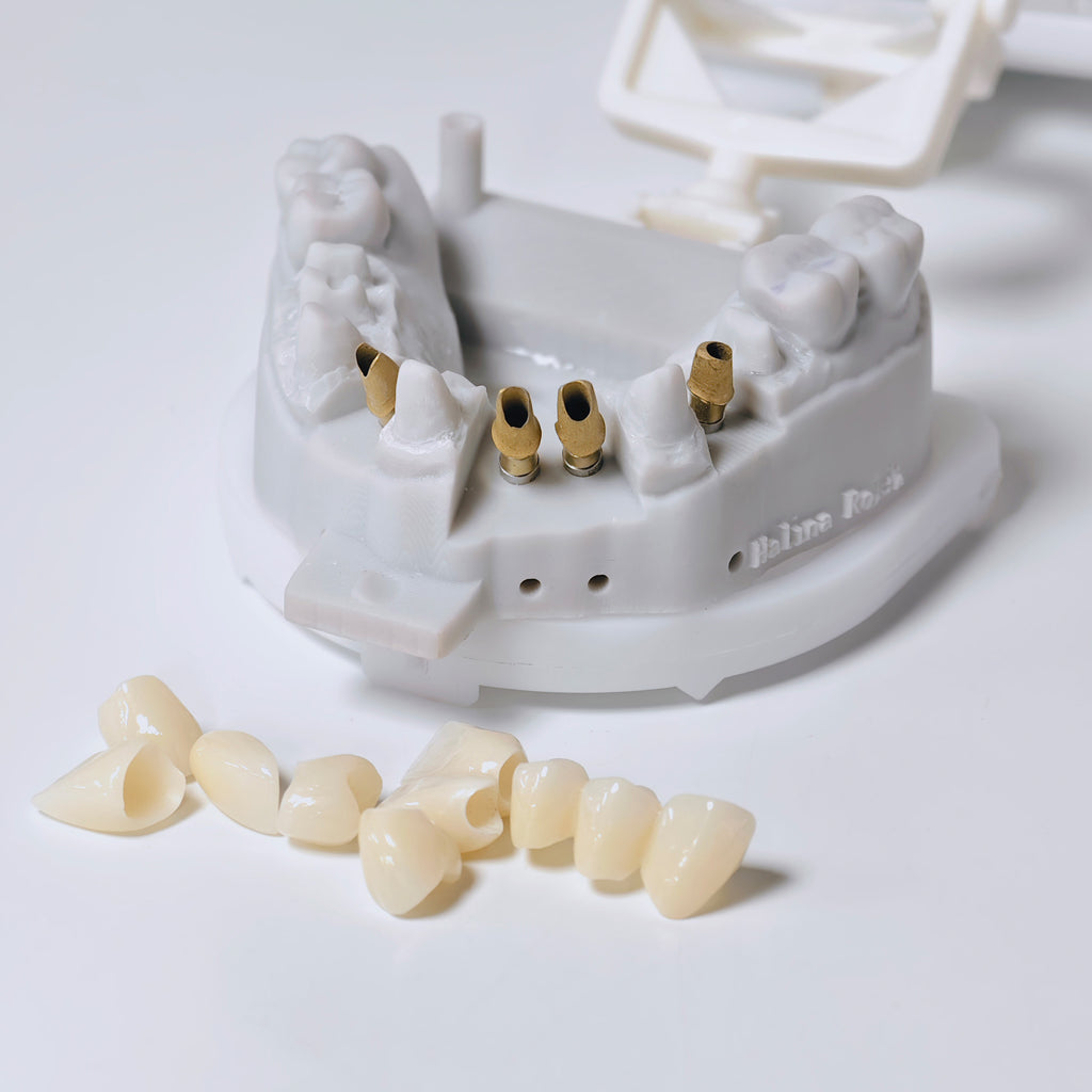 Zirconia Implant Crown And Bridge Screwmentable Dental Crown
