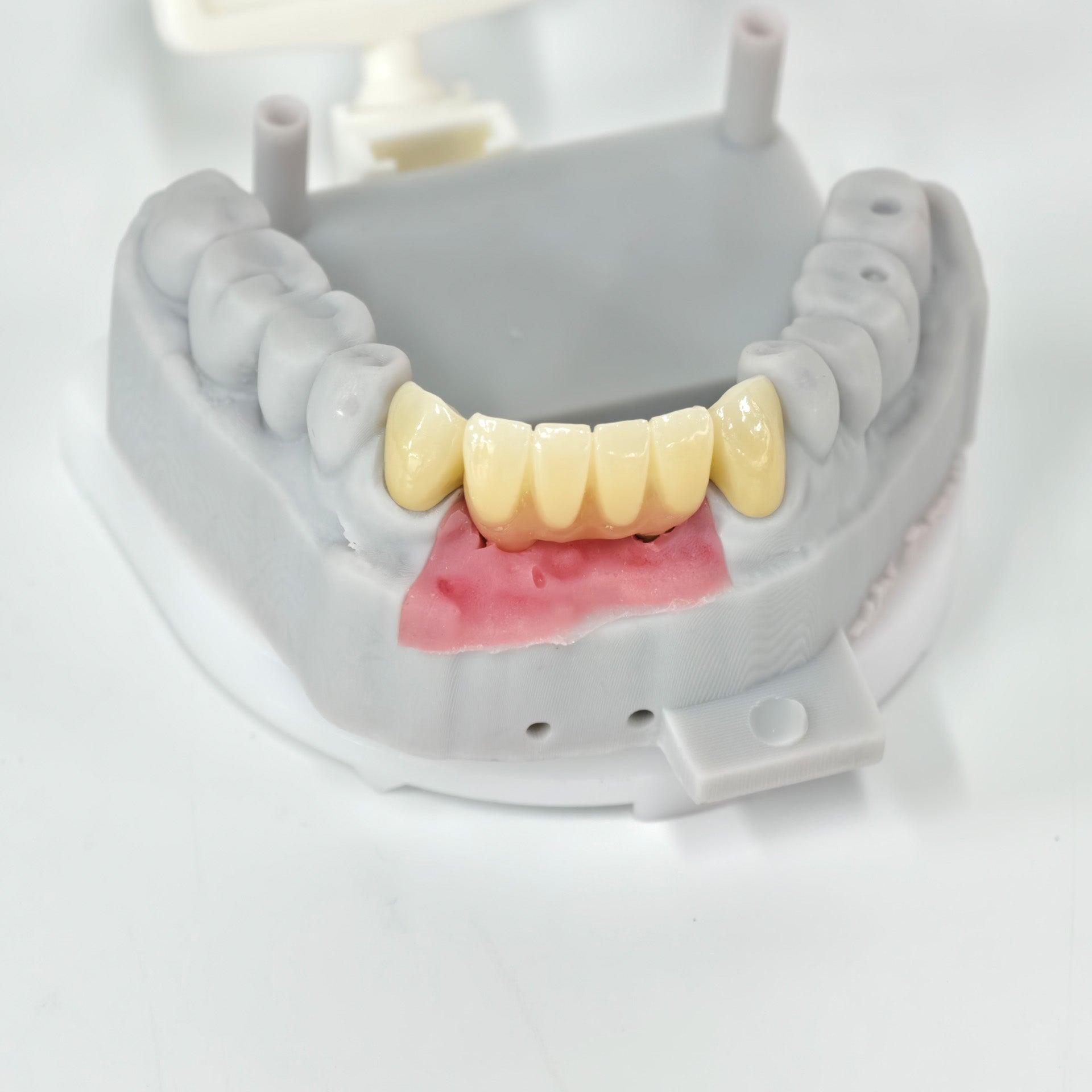 Zirconia Implant Crown And Bridge Screwmentable Dental Crown