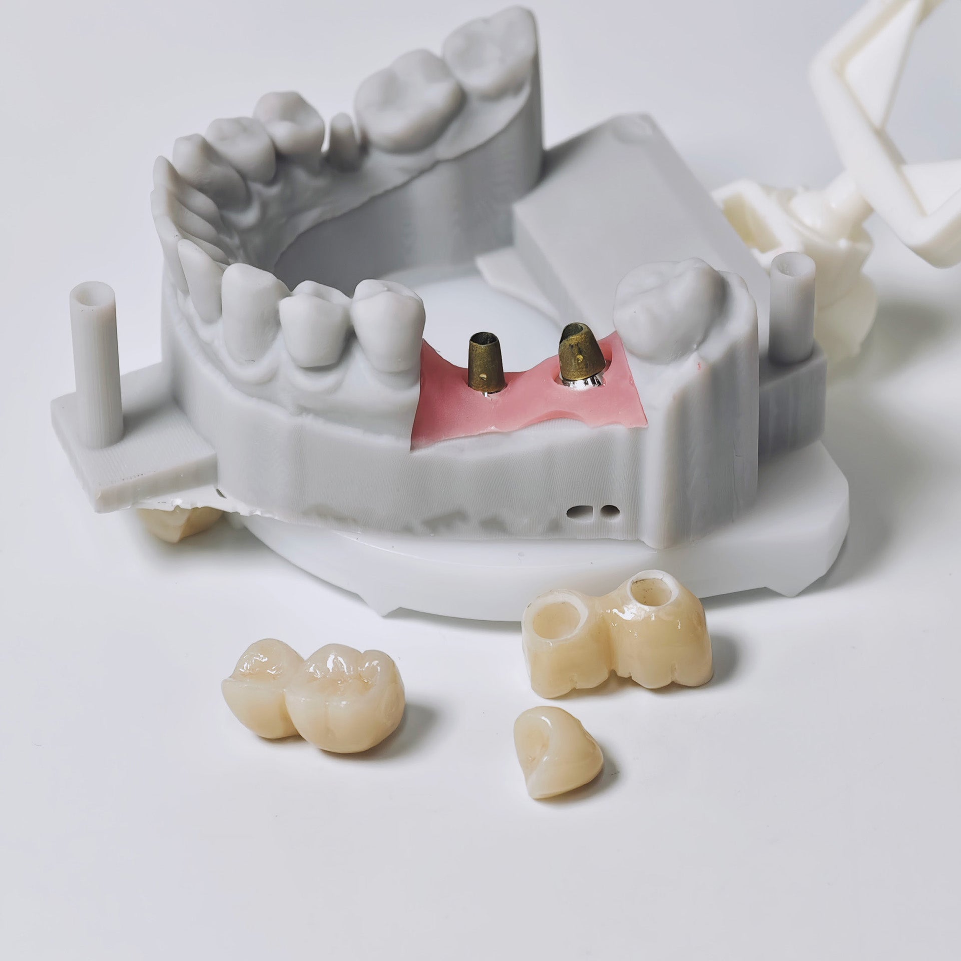 Zirconia Implant Crowns And Bridges Screwmentable Dental Crown