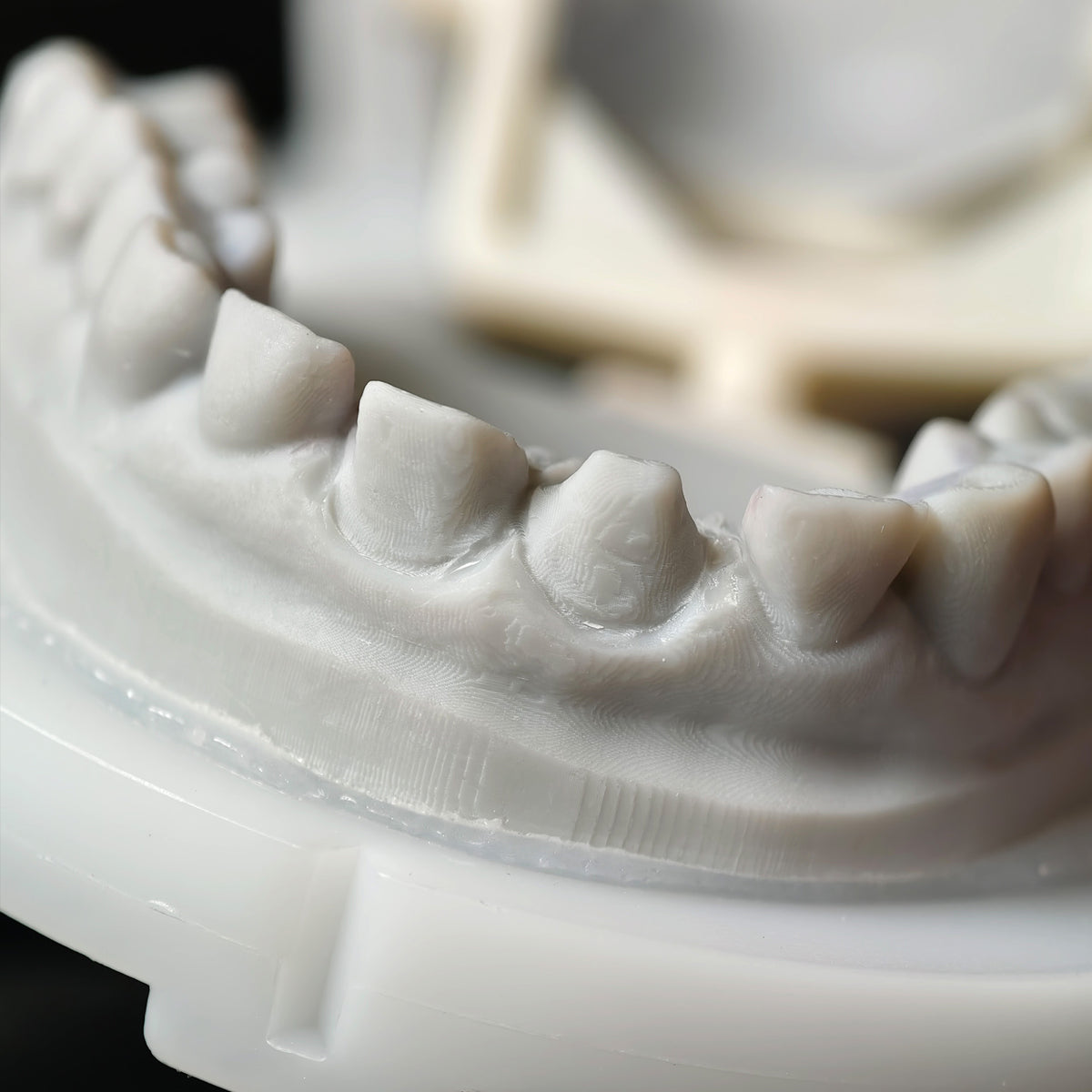 Zirconia Veneer. High Transparency/Translucent, Natural Shade