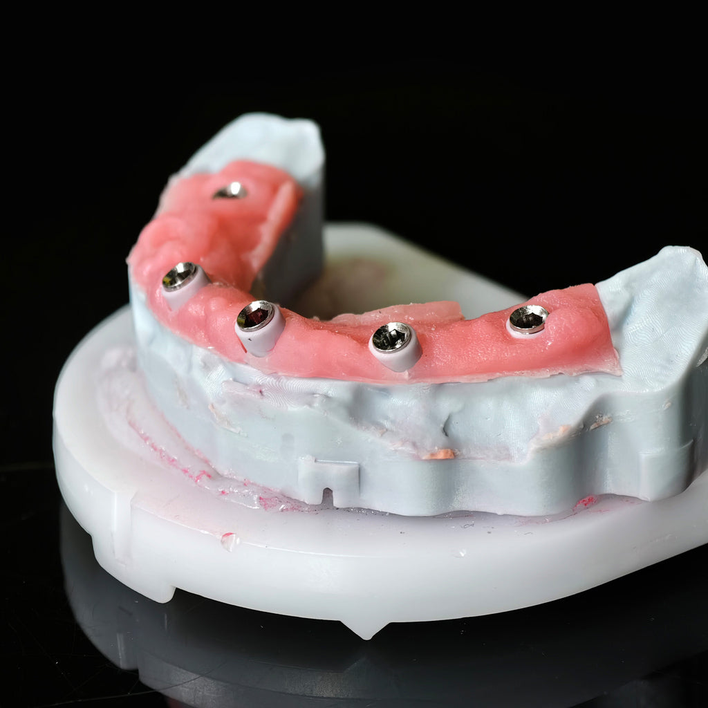 Acrylic Denture With Screw Retained