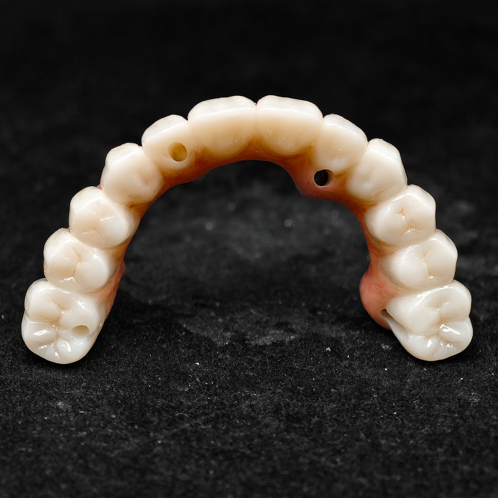 All On 4 Zirconia Bridge With Ti-Base Screw Retained Trying For Full Arch Restoration