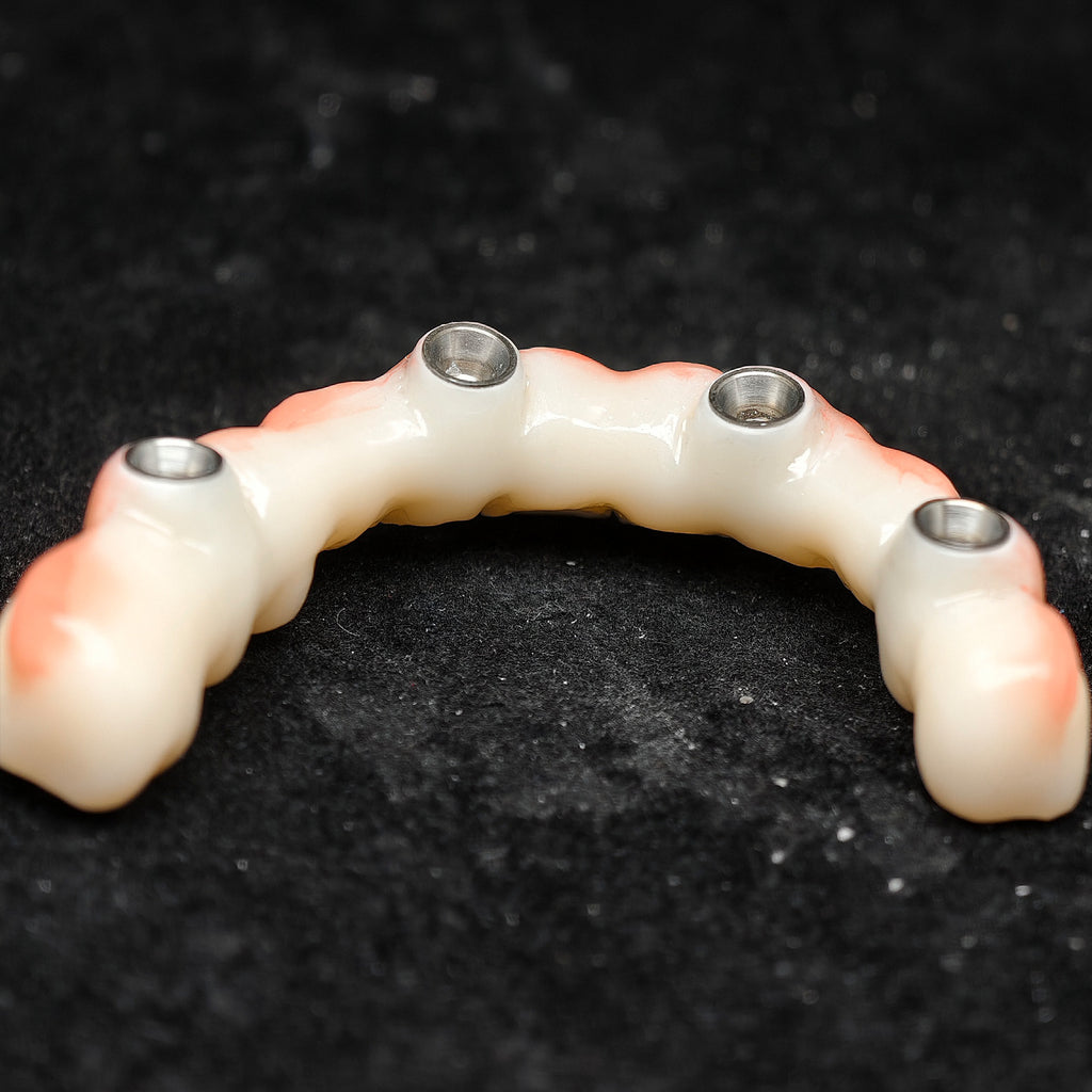 All On 4 Zirconia Bridge With Ti-Base Screw Retained Trying For Full Arch Restoration