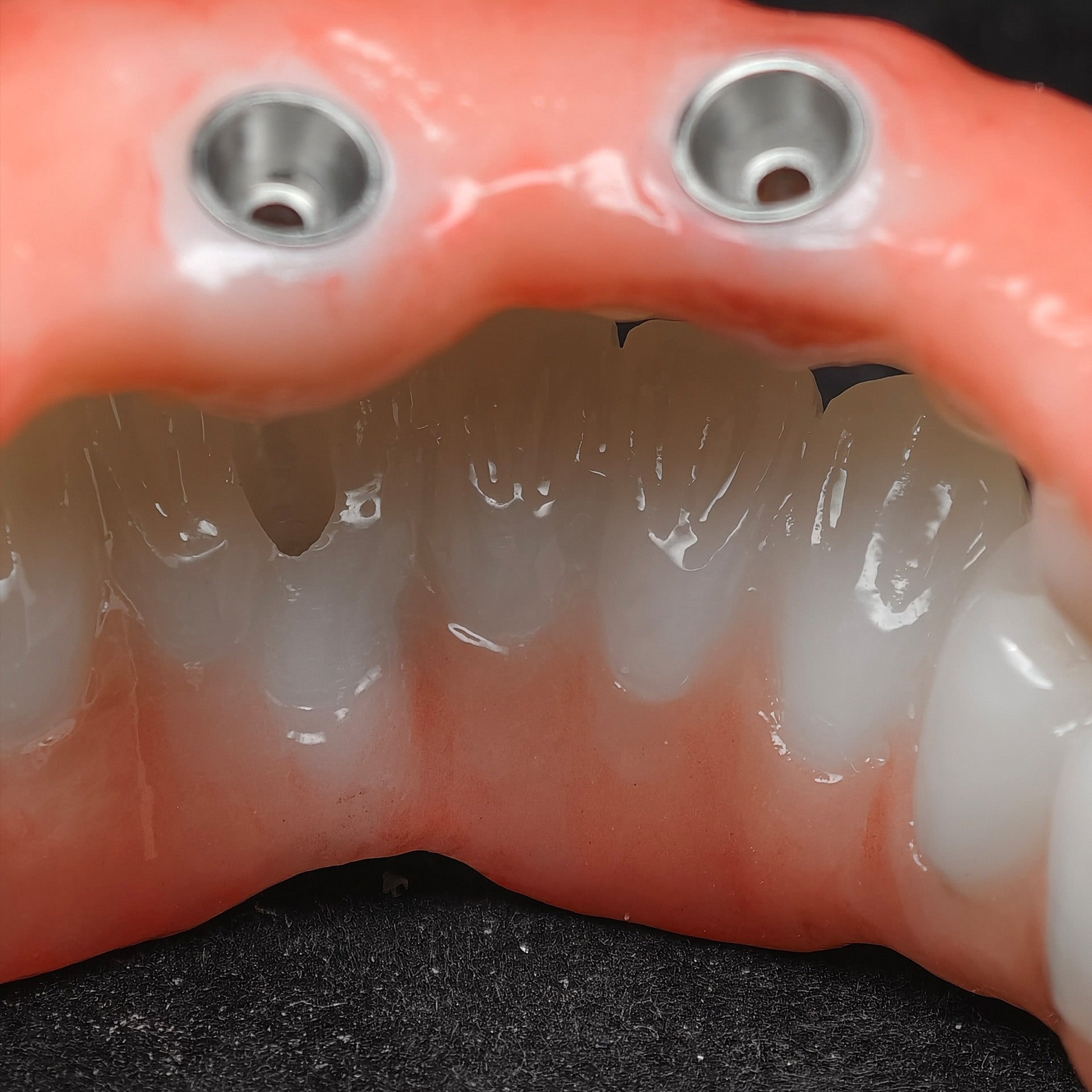 All On 4 Zirconia Bridge With Ti-Base Screw Retained Trying For Full Arch Restoration