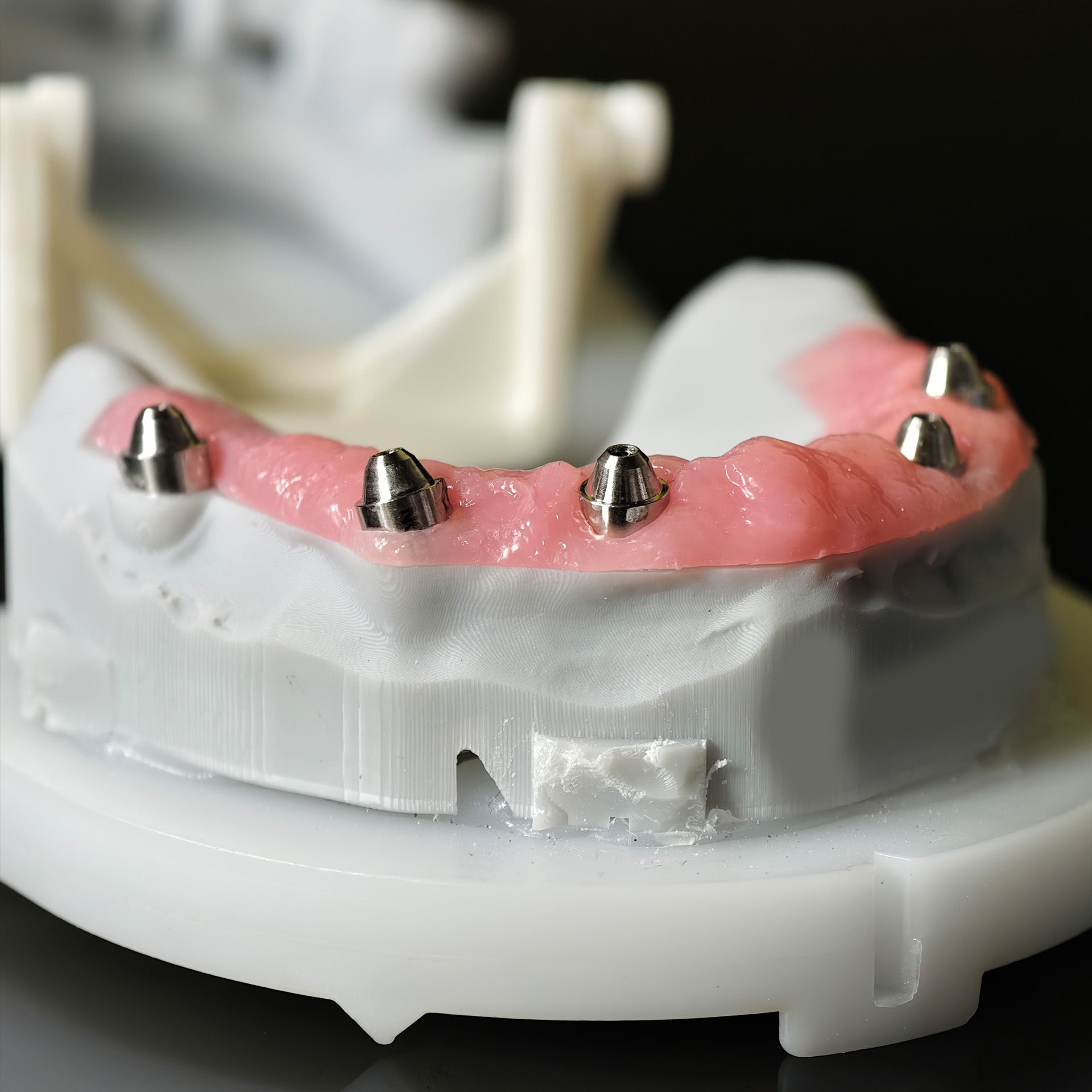 All On 5 Zirconia Bridge With Ti-Base Screw Retained Trying For Full Arch Restoration