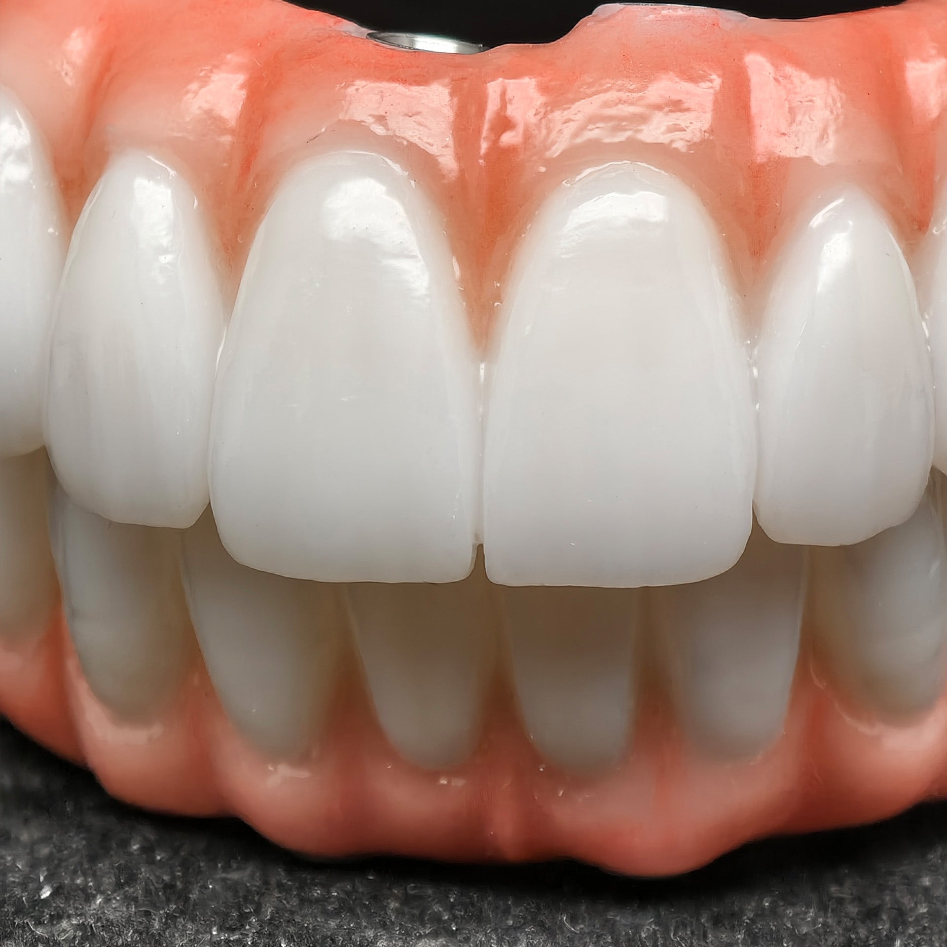 All On 5 Zirconia Bridge With Ti-Base Screw Retained Trying For Full Arch Restoration