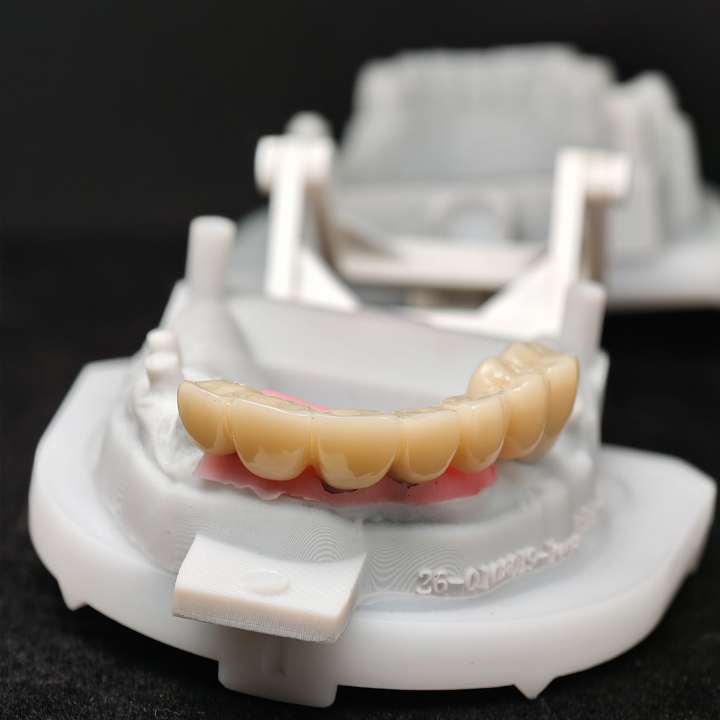Custom Abutment With Zirconia Crown And Bridge