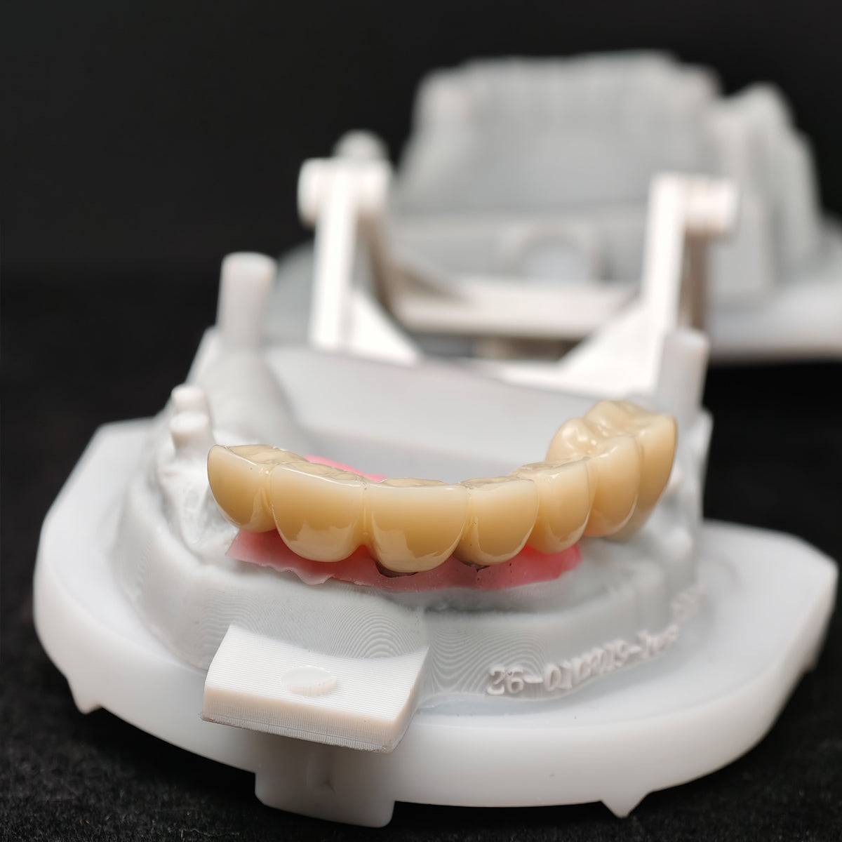Custom Abutment With Zirconia Crown And Bridge