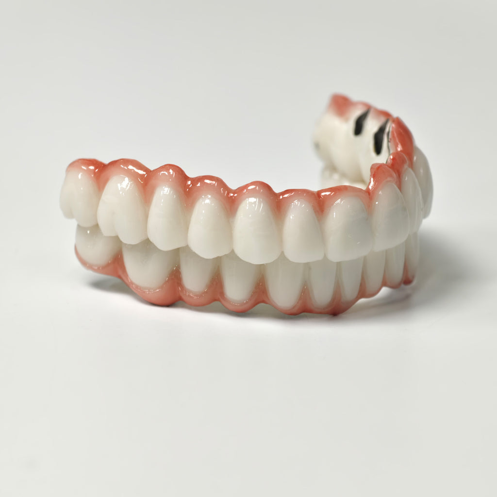 Full-Arch PFM Bridge With Screw Retained