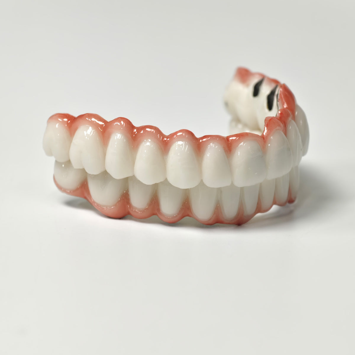 Full-Arch PFM Bridge With Screw Retained
