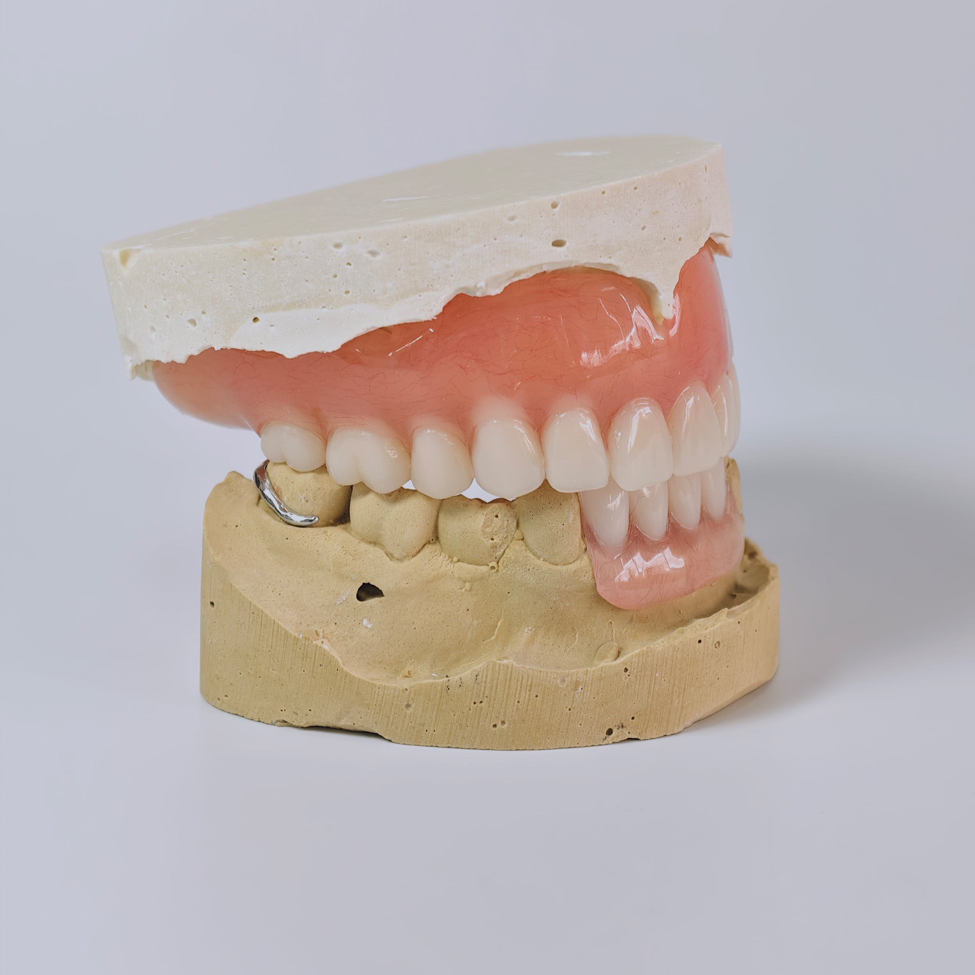 Full-Mouth Acrylic Denture