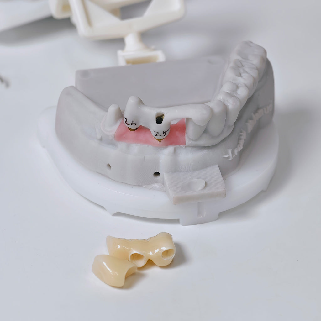Full-Zirconia Crown And Bridge With Cement Retained And Co-Cr Frame Partial Denture